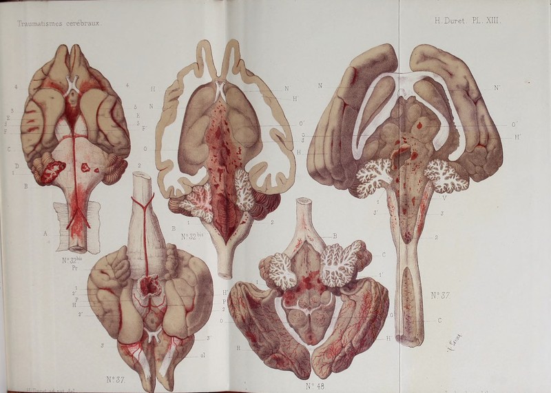 H. Duret. PL . XIII
