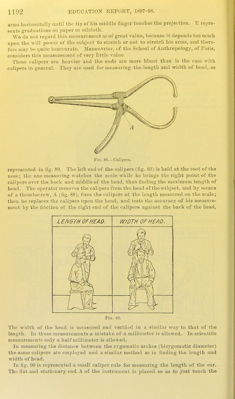 anus horizontally until the tip of bis micldle finger touches the projection. E repre- sents graduations on paper or oilcloth. We do not regard this measurement as of great value, because it depends too ranch upon the will power of the subject to stretch or not to stretch his arms, and there- fore may be quite inaccurate. Manonvrier, of the School of Anthropology, of Paris, considers this measurement of very little value. These calipers are heavier and the ends are more blunt than is the case with calipers iu general. They are used for measuring the length and width of head, as Fig. 88.—Calipers. represented iu fig. 89. The left end of the calipers (fig. 89) is held at the root of the nose; the one measuring watches the scale while he brings the right point of the calipers over the buck and middle of the head, thus finding the maximum length of head. The operator removes the calipers from the head of the subject, and by means of a thumbscrew, A (fig. 88), fixes the calipers at the length measured on the scale; then he replaces tlie calipers upon the head, and tests the accuracy of his measiire- meut by the friction of the right end of the calipers against the back of the head. FlQ. 89. The width of the head is measured and verified in a similar way to that of the length. In these measurements a mistake of a millimeter is allowed. In scientific measurements only a half nnllinieter is allowed. Iu measuring the distance between the zygomatic arches (bizygomatic diameter) the same calipers are employed and a similar method as iu finding the length and width of head. In fig. 90 is represented a small caliper rule for measuring the length of the ear. The fiat and stationary end A of the instrument is placed so as to just touch the