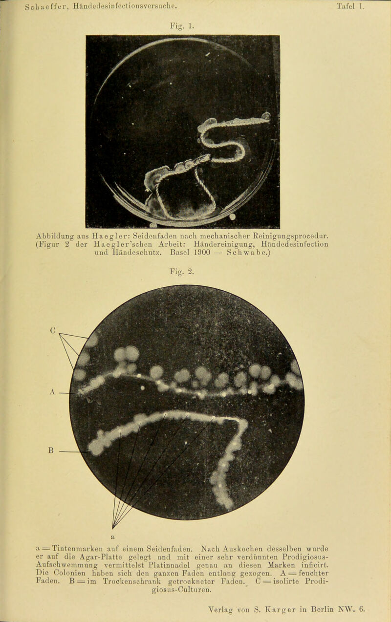 Abbildung ans Haegier: Seidenfaden nach mechanischer Reinigengsprocedur. (Figur 2 der Haegler’schen Arbeit: Händereinigung, Händedesinfection und Händeschutz. Basel 1900 — Schwabe.) Fig. 2. C A B a a = Tintenmarken auf einem Seidenfaden. Nach Auskochen desselben wurde er auf die Agar-Platte gelegt und mit einer sehr verdünnten Prodigiosus- Aufschwemmung vermittelst Platinnadol genau an diesen Marken inficirt. Hie Colonien haben sich den ganzen Faden entlang gezogen. A = feuchter Faden. B = im Trockenschrank getrockneter Faden. C = isolirte Prodi- giosus-Culturen.