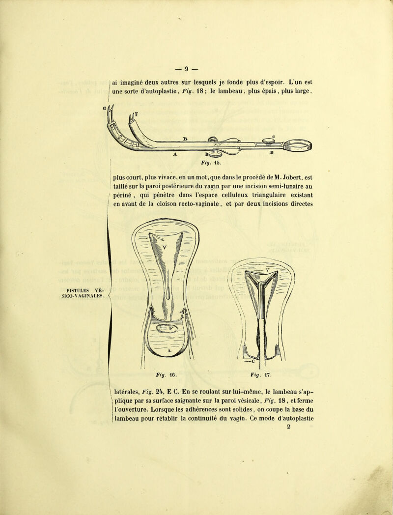 ai imaginé deux autres sur lesquels je fonde plus d'espoir. L'un est une sorte d'autoplastie, Fig. 18 ; le lambeau, plus épais, plus large. G Fig. 15. plus court, plus vivace, en un mot, que dans le procédé de M. Jobert, est taillé sur la paroi postérieure du vagin par une incision semi-lunaire au / périné , qui pénètre dans l'espace celluleux triangulaire existant I en avant de la cloison recto-vaginale, et par deux incisions directes FISTULES VÉ- SICO-VAGINALES. Fig. 16. Fig. 17. \ latérales, Fi§. 24, E C. En se roulant sur lui-même, le lambeau s'ap- \ plique par sa surface saignante sur la paroi vésicale, Fi§. 18, et ferme I l'ouverture. Lorsque les adhérences sont solides, on coupe la base du i lambeau pour rétablir la continuité du vagin. Ce mode d'autoplastie 2