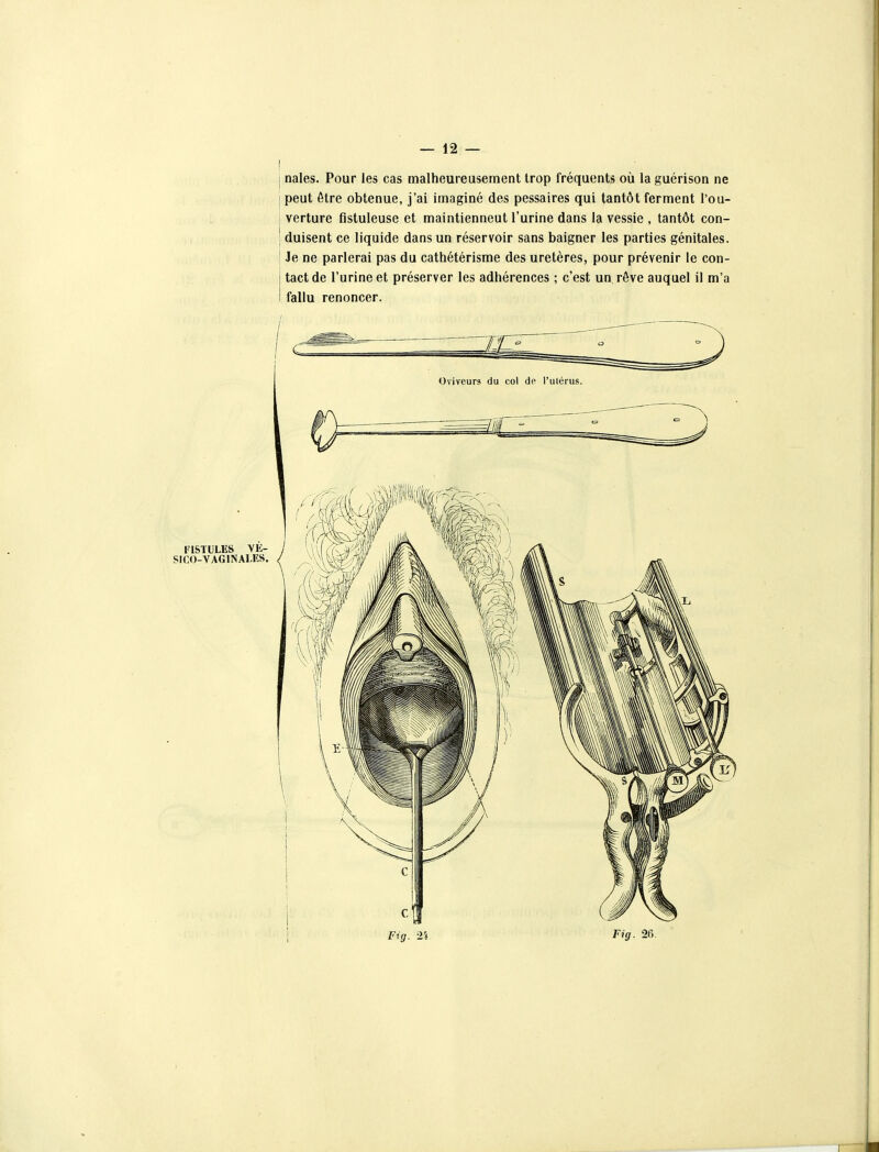 ! I nales. Pour les cas malheureusement trop fréquents où la guérison ne j peut être obtenue, j'ai imaginé des pessaires qui tantôt ferment l'ou- i verture flstuleuse et maintiennent l'urine dans la vessie , tantôt con- j duisent ce liquide dans un réservoir sans baigner les parties génitales. I Je ne parlerai pas du cathétérisme des uretères, pour prévenir le con- i tact de l'urine et préserver les adhérences ; c'est un rêve auquel il m'a I fallu renoncer.