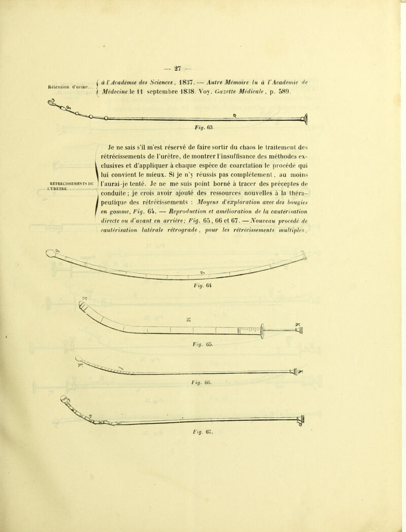 ( à l'Académie des Sciences, 1837. — Autre Mémoire lu à l'Académie de Rélenlioii d'urine... ; ) Médecine le 11 septembre 1838. Voy. Gazette Médicale, p. 589. Fig. 63. BETBECISSEMENTS DE 1,'liRÊTBE Je ne sais s'il m'est réservé de faire sortir du chaos le traitement des rétrécissements de l'urètre, de montrer l'insuffisance des méthodes ex- clusives et d'appliquer à chaque espèce de coarctation le procédé qui lui convient le mieux. Si je n'y réussis pas complètement, au moins l'aurai-je tenté. Je ne me suis point borné à tracer des préceptes de conduite ; je crois avoir ajouté des ressources nouvelles à la théra- peutique des rétrécissements : Moyens d'exploration avec des bougies en gomme, Fig. 64. — Reproduction et amélioration de la cautérisation directe ou d'avant en arrière; Fig. 65, 66 et 67. —Nouveau procédé de \ cautérisation latérale rétrograde , pour les rétrécissements multiples, Fig. 64 Fig. 05. Fig. 6(). Fig. 67.