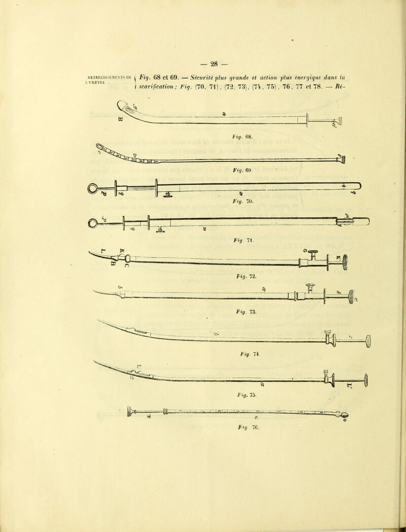 KEiRECissEJiKNTsrjE ^ Fig. 68 et 69. —Sécurité plus grande et action plus énergique dans la ) scarifcation; Fig. (70, 71). (72, 73), (74, 75) , 76, 77 et 78. — fie- Fig. 68, Fig. 73. Fig. 74. —— i-'fi/. 75. 76.