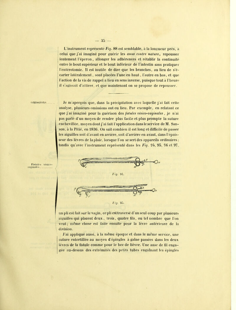 L'instrument représenté Fig. 88 est sennblable, à la loni^ueur près, à celui que j'ai imaginé pour guérir les anus contre nature, repousser lentement l'éperon, allonger les adhérences et rétablir la continuité entre le bout supérieur et le bout inférieur de l'intestin sans pratiquer l'entérotomie. II est inutile de dire que les branches, au lieu de s'é- carter latéralement, sont placées l'une en haut, l'autre en bas, et que l'action de la vis de rappel a lieu en sens inverse, puisque tout à l'heure il s'agissait d'attirer, et que maintenant on se propose de repousser. Je m'aperçois que, dans la précipitation avec laquelle j'ai fait cette / analyse, plusieurs omissions ont eu lieu. Par exemple, en relatant ce I que j'ai imaginé pour la guérison des fistules vésico-vaginales , je n'ai pas parlé d'un moyen de rendre plus facile et plus prompte la suture enchevillée, moyen dont j'ai fait l'application dans le service de M. San- son, à la Pitié, en 1836. On sait combien il est long et difficile de passer les aiguilles soit d'avant en arrière, soit d'arrière en avant, dans l'épais- I seur des lèvres de la plaie, lorsque l'on se sert des appareils ordinaires ; I tandis qu'avec l'instrument représenté dans les Fig. 94, 95, 96 et 97, fi'j. 95. I un pli est fait sur le vagin, ce pli esttraversé d'un seul coup par plusieurs j aiguilles qui placent doux , trois, quatre fils, ou tel nombre que l'on I veut; môme chose est faite ensuite pour la lèvre antérieure de la \ division. J'ai appliqué aussi, à la même époque et dans le même service, une suture entortillée au moyen d épingles à gaîne passées dans les deux lèvres de la fistule comme pour le bec de lièvre. Une anse de fil enga- gée au-dessus des extrémités des petits tubes engainant les épingles