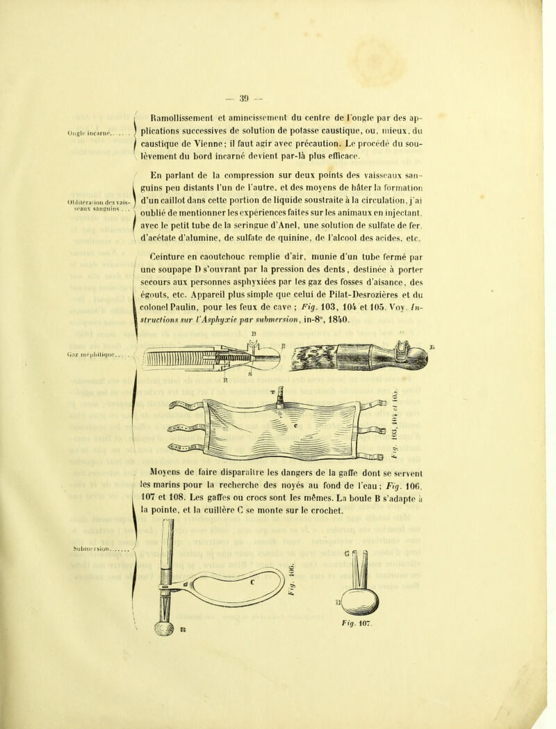 Ongle incarné. 01)1 itéra lion des vais- seaux sanguins.... Gaz inépliiliqiie. Ramollissement et amincisscrneiit du centre de l'ongle par des ap- plications successives de solution de potasse caustique, ou, mieux, du caustique de Vienne; il faut agir avec précaution. Le procédé du sou- V lèvement du bord incarné devient par-là plus efTicace. En parlant de la compression sur deux points des vaisseaux san- guins peu distants l'un de l'autre, et des moyens de hâter la formation d'un caillot dans cette portion de liquide soustraite à la circulation, j'ai oublié de mentionner les expériences faites sur les animaux en injectant, avec le petit tube de la seringue d'Anel, une solution de sulfate de fer. d'acétate d'alumine, de sulfate de quinine, de l'alcool des acides, etc. Ceinture en caoutchouc remplie d'air, munie d'un tube fermé par une soupape D s'ouvrant par la pression des dents, destinée à porter secours aux personnes asphyxiées par les gaz des fosses d'aisance, des égouts, etc. Appareil plus simple que celui de Pilat-Desrozières et du colonel Paulin, pour les feux de cave ; Fig. 103, 104 et 105. Voy. !n- structions sur l'Asphyxie par submersion, in-S, 1840. B Moyens de faire disparaître les dangers de la gaffe dont se servent i les marins pour la recherche des noyés au fond de l'eau; Fig. 106. 107 et 108. Les gaffes ou crocs sont les mêmes. La boule B s'adapte à la pointe, et la cuillère C se monte sur le crochet. fl