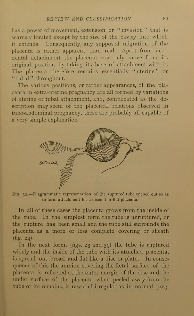 has a power of movement, extension or “invasion” that is scarcely limited except by the size of the cavity into which it extends. Consequently, any supposed migration of the placenta is rather apparent than real. Apart from acci- dental detachment the placenta can only move from its original position by taking its base of attachment with it. The placenta therefore remains essentially “ uterine ” or “ tubal ” throughout. The various positions, or rather appearances, of the pla- centa in extra-uterine pregnancy are all formed by variations of uterine or tubal attachment, and, complicated as the de- scription may seem of the placental relations observed in tubo-abdominal pregnancy, these are probably all capable of a very simple explanation. Fig. 39.—Diagrammatic representation of the ruptured tube opened out so as to form attachment for a discoid or flat placenta. In all of these cases the placenta grows from the inside of the tube. In the simplest form the tube is unruptured, or the rupture has been small and the tube still surrounds the placenta as a more or less complete covering or sheath (fig. 24). In the next form, (figs. 23 and 39) the tube is ruptured widely and the inside of the tube with its attached placenta,, is spread out broad and flat like a disc or plate. In conse- quence of this the amnion covering the foetal surface of the placenta is reflected at the outer margin of the disc and the under surface of the placenta when peeled away from the tube or its remains, is raw and irregular as in normal preg-