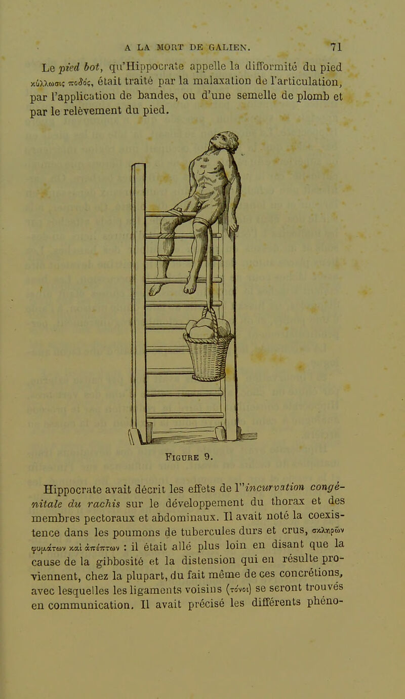 Le pied bot, qu'Hippocrate appelle la difformité du pied xôxxwoiî lïo^o'ç, était traité par la malaxalion de l'articulation, par l'application de bandes, ou d'une semelle de plomb et par le relèvement du pied. Figure 9. Hippocrate avait décrit les effets de rincurvation congé- nitale du rachis sur le développement du thorax et des membres pectoraux et abdominaux. Il avait noté la coexis- tence dans les poumons de tubercules durs et crus, orxXYipûv çufiiâTwv y.al àireivTwv : il était allé plus loin en disant que la cause de la gibbosité et la distension qui en résulte pro- viennent, chez la plupart, du fait même de ces concrétions, avec lesquelles les ligaments voisins (to'voi) se seront trouvés en communication. Il avait précisé les différents phéno-