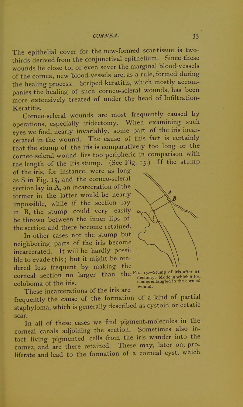 The epithelial cover for the new-formed scar-tissue is two- thirds derived from the conjunctival epithelium. Since these wounds lie close to, or even sever the marginal blood-vessels of the cornea, new blood-vessels are, as a rule, formed during the healing process. Striped keratitis, which mostly accom- panies the healing of such corneo-scleral wounds, has been more extensively treated of under the head of Infiltration- Keratitis. Corneo-scleral wounds are most frequently caused by operations, especially iridectomy. When examining such eyes we find, nearly invariably, some part of the iris incar- cerated in the wound. The cause of this fact is certainly that the stump of the iris is comparatively too long or the corneo-scleral wound lies too peripheric in comparison with the length of the iris-stump. (See Fig. 15.) If the stump of the iris, for instance, were as long as S in Fig. 15, and the corneo-scleral section lay in A, an incarceration of the former in the latter would be nearly impossible, while if the section lay in B, the stump could very easily be thrown between the inner lips of the section and there become retained. In other cases not the stump but neighboring parts of the iris become incarcerated. It will be hardly possi- ble to evade this ; but it might be ren- dered less frequent by making the , ,1 Fig is.—Stump of iris after iri- corneal section no larger than the dectlmy MoFde ln which it be_ coloboma of the iris. w7undeiltangled ^ C°rnea' These incarcerations of the iris are woun ' frequently the cause of the formation of a kind of partial staphyloma, which is generally described as cystoid or ectatic scar. In all of these cases we find pigment-molecules in the corneal canals adjoining the section. Sometimes also in- tact living pigmented cells from the iris wander into the cornea, and are there retained. These may, later on, pro- liferate and lead to the formation of a corneal cyst, which