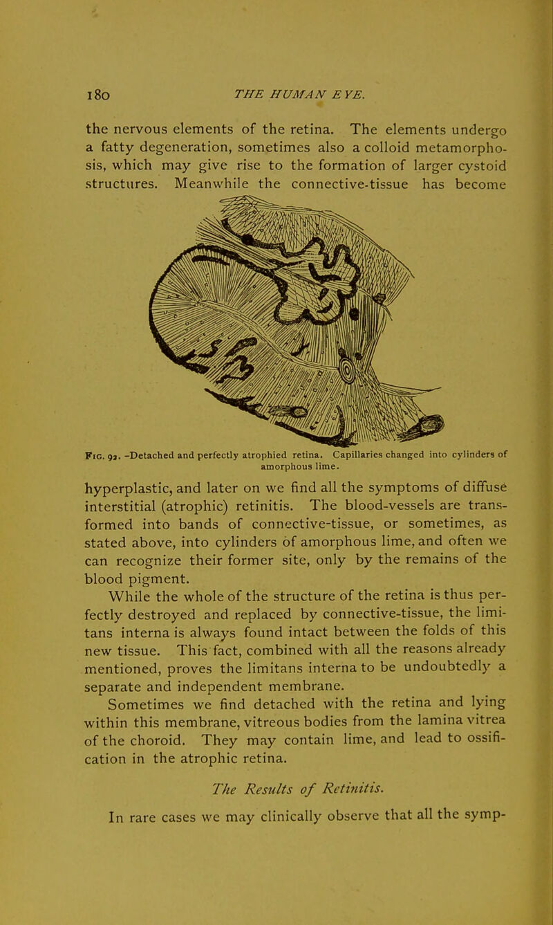 the nervous elements of the retina. The elements undergo a fatty degeneration, sometimes also a colloid metamorpho- sis, which may give rise to the formation of larger cystoid structures. Meanwhile the connective-tissue has become Fig. 92. -Detached and perfectly atrophied retina. Capillaries changed into cylinders of amorphous lime. hyperplastic, and later on we find all the symptoms of diffuse interstitial (atrophic) retinitis. The blood-vessels are trans- formed into bands of connective-tissue, or sometimes, as stated above, into cylinders of amorphous lime, and often we can recognize their former site, only by the remains of the blood pigment. While the whole of the structure of the retina is thus per- fectly destroyed and replaced by connective-tissue, the limi- tans interna is always found intact between the folds of this new tissue. This fact, combined with all the reasons already mentioned, proves the limitans interna to be undoubtedly a separate and independent membrane. Sometimes we find detached with the retina and lying within this membrane, vitreous bodies from the lamina vitrea of the choroid. They may contain lime, and lead to ossifi- cation in the atrophic retina. The Results of Retinitis. In rare cases we may clinically observe that all the symp-