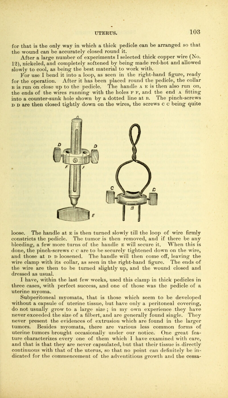 for that is the only way in which a thick pedicle can be arranged so that the wound can be accurately closed round it. After a large number of experiments I selected thick copper wire (No. 12), nickeled, and completely softened by being made red-hot and allowed slowly to cool, as being the best material to work with. For use I bend it into a loop, as seen in the right-hand figure, ready for the operation. After it has been placed round the pedicle, the collar B is run on close up to the pedicle. The handle a e is then also run on, the ends of the wires running with the holes F f, and the end a fitting into a counter-sunk hole shown by a dotted line at b. The pinch-screws D D are then closed tightly down on the wires, the screws c c being quite A loose. The handle at e is then turned slowly till the loop of wire firmly constricts the pedicle. The tumor is then removed, and if there be any bleeding, a few more turns of the handle e will secure it. When this is done, the pinch-screws c c are to be securely tightened down on the wire, and those at d D loosened. The handle will then come off, leaving the wire clamp with its collar, as seen in the right-hand figure. The ends of the wire are then to be turned slightly up, and the wound closed and dressed as usual. I have, within the last few weeks, used this clamp in thick pedicles in three cases, with perfect success, and one of those was the pedicle of a uterine myoma. Subperitoneal myomata, that is those which seem to be developed without a capsule of uterine tissue, but have only a peritoneal covering, do not usually grow to a large size ; in my own experience they have never exceeded the size of a filbert, and are generally found single. They never present the evidences of extrusion which are found in the larger tumors. Besides myomata, there are various less common forms of uterine tumors brought occasionally under our notice. One great fea- ture characterizes every one of them which I have examined with care, and that is that they are never capsulated, but that their tissue is.directly continuous with that of the uterus, so that no point can definitely be in- dicated for the commencement of the adventitious growth and the cessa-