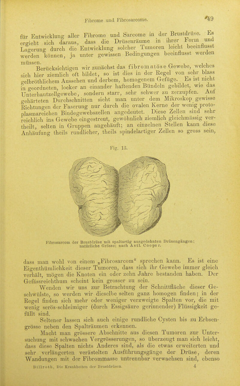 ^49 für Entwicklung- aller Fibrome und Sarcome m der Brustdruse. Es ergiebt sich daraus, dass die Drüsenräimie in ihrer Form und Lao-erunff durch die Entwicklung solcher Tumoren leicht beeinflusst wenden können, ja unter gewissen Bedingungen beeinflusst werden ^^^^^^Berücksichtigen wir zunächst das fibromatöse Gewebe, welches sich hier ziemlich oft bildet, so ist dies in der Regel von sehr blass o-elbröthlichem Aussehen und derbem, homogenem Gefüge. Es ist nicht fn o-eordneten, locker an einander haftenden Bündeln gebildet, wie das Unterhautzellgewebe, sondern starr, sehr schwer zu zerzupfen. Auf o-ehcärteten Durchschnitten sieht man unter dem Mikroskop gewisse Richtungen der Faserung nur durch die ovalen Kerne der wenig proto- plasmareichen Biudegewebszellen angedeutet. Diese Zellen sind sehr reichlich ins Gewebe eingestreut, gewöhnlich ziemlich gleichmcässig yer- theilt, selten in Gruppen angehäuft; an einzelnen Stellen kann diese Anhäufung theils rundlicher, theils spindelartiger Zellen so gross sein, Fig. 13. Fibrosarcom der Brustdrüse mit spaltartiff ausgedehnten Drüsengängen; natürliche Grösse; nach Astl. Cooper. dass man wohl von einem „Fibrosarcom sprechen kann. Es ist eine Eigenthümlichkeit dieser Tumoren, dass sich ihr Gewebe immer gleich verhält, mögen die Knoten ein oder zehn Jahre bestanden haben. Der Gefässreichthum scheint kein grosser zu sein. Wenden wir vms zur Betrachtung der Schnittfläche dieser Ge- schwülste, so werden wir dieselbe selten ganz homogen finden; in der Regel finden sich mehr oder weniger verzweigte Spalten vor, die mit wenig serös-schleimiger (durch Essigsäure gerinnender) Flüssigkeit ge- füllt sind. Seltener lassen sich auch einige rundliche Cysten bis zu Erbsen- grösse neben den Spalträumen erkennen. Macht man grössere Abschnitte aus diesen Tumoren zur Unter- suchung mit schwachen Vergrösserungen, so überzeugt man sich leicht, dass diese Spalten nichts Anderes sind, als die etwas erweiterten und sehr verlängerten verästelten Ausführungsgänge der Drüse, deren Wandungen mit der Fibrommasse untrennbar verwachsen sind, ebenso