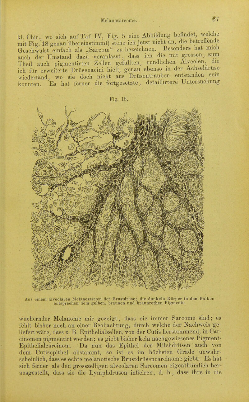 «7 kl. Chir., wo sich auf Taf. IV, Fig. 5 eine Abbilrlung befindet, welche mit Fig. 18 genau übereinstimmt) stehe ich jetzt nicht an, die betrettende Geschwulst einfach als „Sarcom zu bezeichnen. Besonders hat mich auch der Umstand dazu veranlasst, dass ich die mit grossen, zum Theil auch pigmentirten Zellen gefüllten, rundlichen Alveolen, die ich für erweiterte Drüsenacini hielt, genau ebenso in der Achseldruse Aviederfand, wo sie doch nicht aus Drüsentrauben entstanden sein konnten Es hat ferner die fortgesetzte, detaillirtere Untersuchung Fig. 18. Aus einem alveolaren Melanosarcom der Brustdrüse; die dunkeln Körper in den Ballten entspreclien dem gelben, braunen und braunrothen Pigmente. wuchernder Melanome mir gezeigt, dass sie immer Sarcome sind; es fehlt bisher noch an einer Beobachtung, durch welche der Nachweis ge- liefert wäre, dass z. B. Epithelialzellen, von der Cutis herstammend, in Car- cinomen pigmentirt werden; es giebt bisher kein nachgewiesenes Pigment- Epithelialcarcinom. Da nun das Epithel der Milchdrüsen auch von dem Cutisepithel abstammt, so ist es im höchsten Grade unwahr- scheinHch, dass es echte melanotische Brustdrüsencarcinome giebt. Es hat sich ferner als den grosszelligen alveolaren Sarcomen eigenthümlich her- ausgestellt, dass sie die Lymphdrüsen inficiren, d. h., dass ihre in die