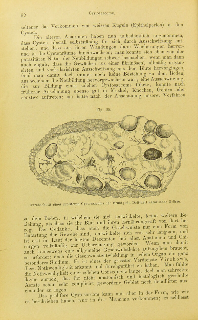 seltener das Vorkommen von weissen Kugeln (Epithclperlen) in den Cysten^^^ filteren Anatomen haben nun unbedenklicii angenommen, dass Cysten überall selbstständig für sich durch Ausschwitzung ent- stehen, und dass aus ihren Wandungen dann Wucherungen hervor- und in die Cystenräume hineinwachsen; man konnte sich eben von der parasitären Natur der Neubildungen schwer losmachen; wenn man dann auch zugab, dass die Gewächse aus einer fibrinösen', allmälig organi- sirten und vaskularisirten Ausschwitzung aus dem Blute hervorgingen, fand man damit doch immer noch keine Beziehung zu dem Boden, aus welchem die Neubildung hervorgewachsen war ; eine Ausschwitzung, die zur Bildung eines solchen Cystosarcoms führte, konnte nach früherer Anschauung ebenso gut in Muskel, Knochen, Gehirn oder sonstwo auftreten; sie hatte nach der Anschauung unserer Vorfahren Figr. 20. Durchschnitt eines proUferen Cystosarcoms der Brustein Drittheil natürlicher Grösse. ZU dem Boden, in welchem sie sich entwickelte, keine ^^it^ere Be- ziehung, als dass sie ihr Blut und ihren Ernährungssaft von doit be- zog Der Gedanke, dass auch die Geschwülste nur eme Form von Entartung der Gewebe sind, entwickelte sich erst sehr langsam und iferTL Lauf der letzten'Decennien bei allen Anatomen und Chi- rurg xV vollständig zur Ueberzeugung geworden. Wenn -an datnit luch keineswegs eine allgemeine Geschwulstlehre aufzugeben braucht, so erfordert doch die Geschwulstentwicklung in jedem Organ exn ganz wtt Studium. Es ist eines der grössten Verdiens e Vn-chow s diese Nothwendigkeit erkannt und durchgeführt zu haben. Man tulil e d e Nothwendigkeit einer solchen Consequenz lange, doch man schreck e Tv^r zx^Jickf das für nicht anatomisch und /-^ologis^^^^^^^^^^^ Aerzte schon sehr complicirt gewordene Gebiet noch detailhitei aus 'pas'pÄ Cystosarcom kann nun aber in der Form, wie wir es bes^hrieC l^ben,^ in der Mamma vorkommen; es schhesst