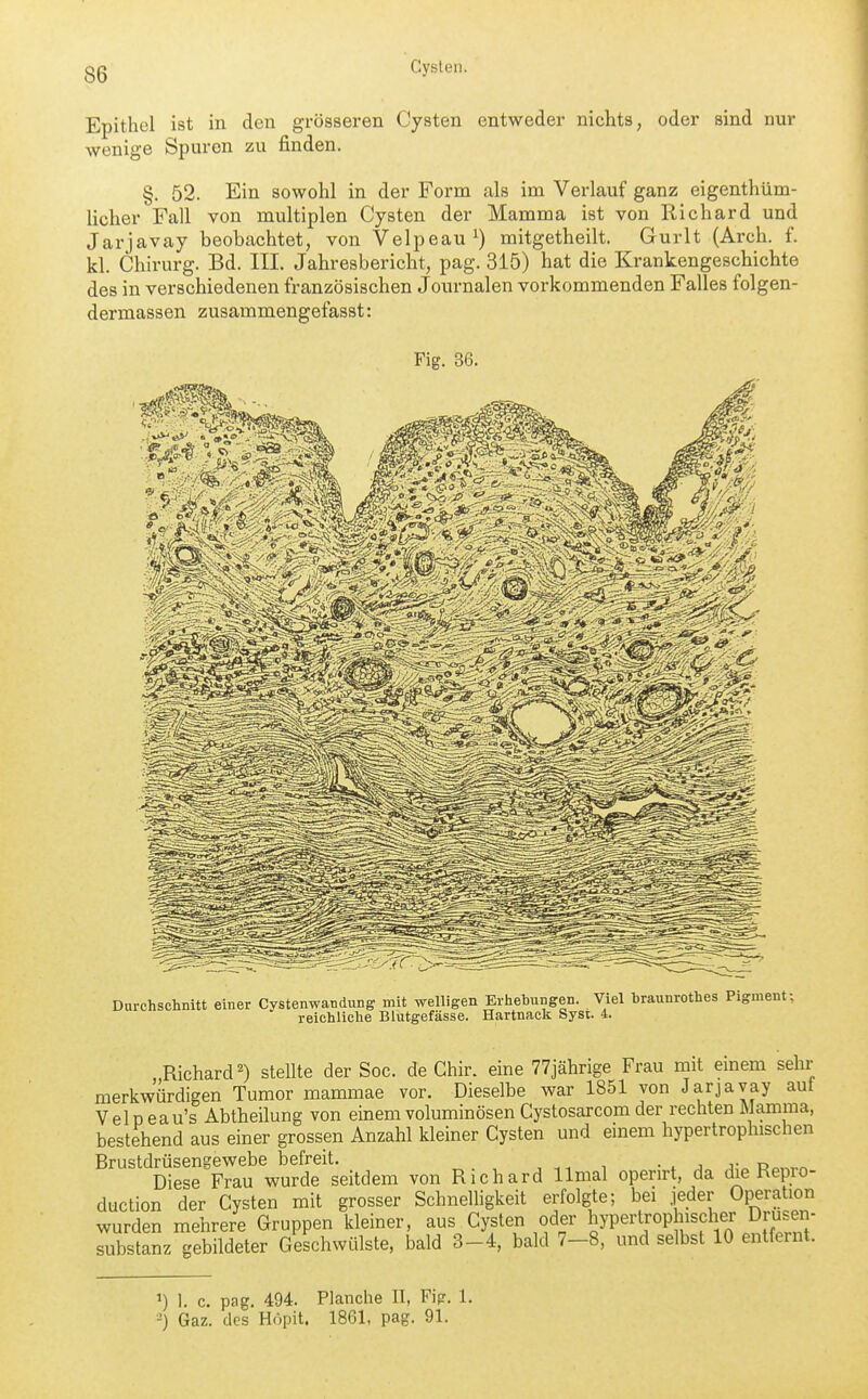 Epithel ist in den grösseren Cysten entweder nichts, oder sind nur wenige Spuren zu finden. §. 52. Ein sowohl in der Form als im Verlauf ganz eigenthüm- licher Fall von multiplen Cysten der Mamma ist von Richard und Jarjavay beobachtet, von Velpeau^) mitgetheilt. Gurlt (Arch. f. kl. Chirurg. Bd. III. Jahresbericht, pag. 315) hat die Krankengeschichte des in verschiedenen französischen Journalen vorkommenden Falles folgen- dermassen zusammengefasst: Fig. 36. HS'yMJ-e'J, '«4-1. Vo«, .'■^i»?-5,;-W/jjl?\'-i<: Durchschnitt einer Cystenwandung mit weUigen Erhehungen. Viel braunrothes Pigment; reichliche Blutgefässe. Hartnack Syst. 4. „Richard^) stellte der Soc. de Chir. eine 77jährige Frau mit einem sehr merkwürdigen Tumor mammae vor. Dieselbe war 1851 von Jarjavay aut Velpeau's Abtheilung von einem voluminösen Cystosarcom der rechten Mamma, bestehend aus einer grossen Anzahl kleiner Cysten und einem hypertrophischen Brustdrüsengewebe befreit. . . j r r, Diese Frau wurde seitdem von Richard llmal operirt, da die Kepro- duction der Cysten mit grosser Schnelligkeit erfolgte; bei jeder Operation wurden mehrere Gruppen kleiner, aus Cysten oder l^yP^^-tjoP ff^f.^ Drusen^ Substanz gebildeter Geschwülste, bald 3-4, bald 7-8, und selbst 10 entfernt. 1) 1. c. pag, 494. Planche II, Fipr. 1. •-) Gaz. des Höpit. 1861, pag. 91.