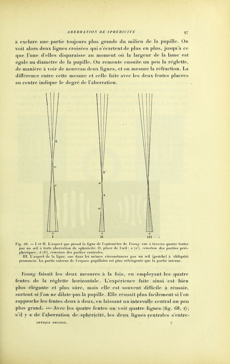 à exclure une partie toujours plus grande du milieu de la pupille. On voit alors deux lignes croisées cpii s'écartent de plus en plus, jusqu'à ce que l'une d'elles disparaisse au moment où la largeur de la lame est égale au diamètre de la pupille. On remonte ensuite un peu la réglette, de manière à voir de nouveau deux lignes, et on mesure la réfraction. La différence entre cette mesure et celle faite avec les deux fentes placées au centre indique le degré de l'aberration. i il ni Fig. 68. — I et II. L'aspect que prend la ligne de l'optomètre de Young, vue à travers quatre fentes par un oeil à forte aberration de sphéricité. O, place de l'œil ; a (a'), remotum des parties péri- phériques ; b (b'), remotum des parties centrales. III. L'aspect de la ligne, vue dans les mêmes circonstances par Un œil (gauche) à obliquité prononcée. La partie externe de l'espace pupillairc est plus réfringente que la partie interne. Young faisait les deux mesures à la fois, en employant les-quatre fentes de là réglette horizontale. L'expérience faite ainsi est bien plus élégante et plus sûre, mais elle est souvent difficile à réussir, surtout si l'on ne dilate pas la pupille. Elle réussit plus facilement si l'on rapproche les fentes deux à deux, en laissant un intervalle central un peu plus grande ^--Avec les quatre fentes on voit quatre lignes (fig. 68, i); •s'il y a de raberration de> sphéricité, les deux lignes centrales s'entre- OPTIQUE PHYSIOL. 7