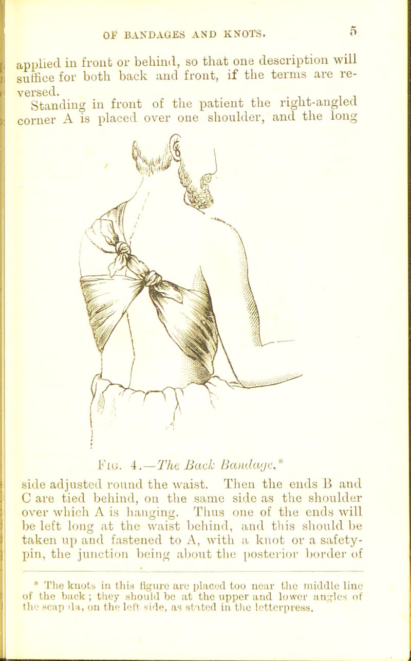 applied in front or behind, so that one description will suffice for both back and front, if the terms are re- versed. Standing in front of the patient the right-angled corner A is placed over one shoulder, and the long Fta. 4.—The Back Bandwje.* side adjusted round the waist. Then the ends B and C are tied behind, on the same side as the shoulder over which A is hanging. Thus one of the ends will be left long at the waist behind, and this should be taken up and fastened to A, with a knot or a safety- pin, the junction being about the posterior border of • The knots in this flgui'e are placed too near Uie niiclclle line of the back ; they .sliould bo at the upper and lower an;^los of tliL' scap ila, on th(; loft >;irle, as stated in the lettorpreas.
