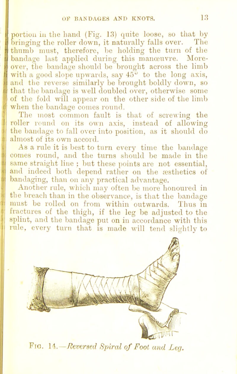 portion ill tlie liaiul (Fig. 13) quite loose, so tliat by bringing tlie roller down, it naturally falls over. The thumb must, therefore, be holding tlie turn of the bandage last aj)plied during this mananivre. More- over, tlie bandage should be brought across the limb with a good slope upwards, say 45'^ to the long axis, and the reverse similarly be lirought boldly down, so that the bandage is well doubled over, otherwise some of the fold will appear on the other side of the limb when the bandage comes round. The most common fault is that of screwing the roller round on its own axis, instead of allowing the bandage to fall over into position, as it should do almost of its own accord. As a rule it is best to turn every time the Ijandage comes round, and the turns should be made in the same straight line : but these points are not essential, and indeed both depend rather on the resthetics of bandaging, than on any practical advantage. Another rule, which may often be more honoured in the breach than in the observance, is that the bandage must be rolled on from within outwards. Thus in fractures of the thigh, if the leg l)e adjusted to the splint, and the bandage put on in accordance witli this rule, every turn that is made will tend slightly to Fio. l\.~/leversed Spiral of Fool and Leij.