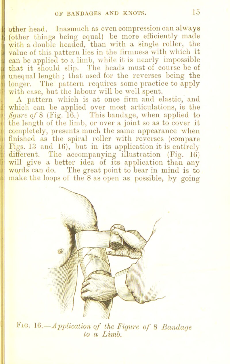 other head. Inasunich as e\-eu compression can always (other things being equal) be more efliciently made with a doulile headed, than with a single roller, the value of this pattern lies in the firmness with whicli it can be applied to a limb, while it is nearly impossible that it shouhl slip. The heads must of course be of unequal length ; that used for the reverses being the longer. The pattern requires some practice to apply with ease, but the labour will be well spent. A pattern which is at once firm and elastic, and which can be applied over most articulations, is the fi(jurt of 8 (Fig. 16.) This bandage, wlien applied to the length of the limb, or over a joint so as to cover it completely, presents much tlie same appearance when finished as the spiral roller with reverses (compare Figs. 13 and 16), but in its application it is entirely different. The accompanying illustration (Fig. 16) will give a better idea of its application tlum any wcu'ds can do. The great point to bear in mind is to make the loops of tlie S as open as possible, by goiug Fig. —Application of Ihc Fvjurn of 8 Bandaijc, la a Limb.