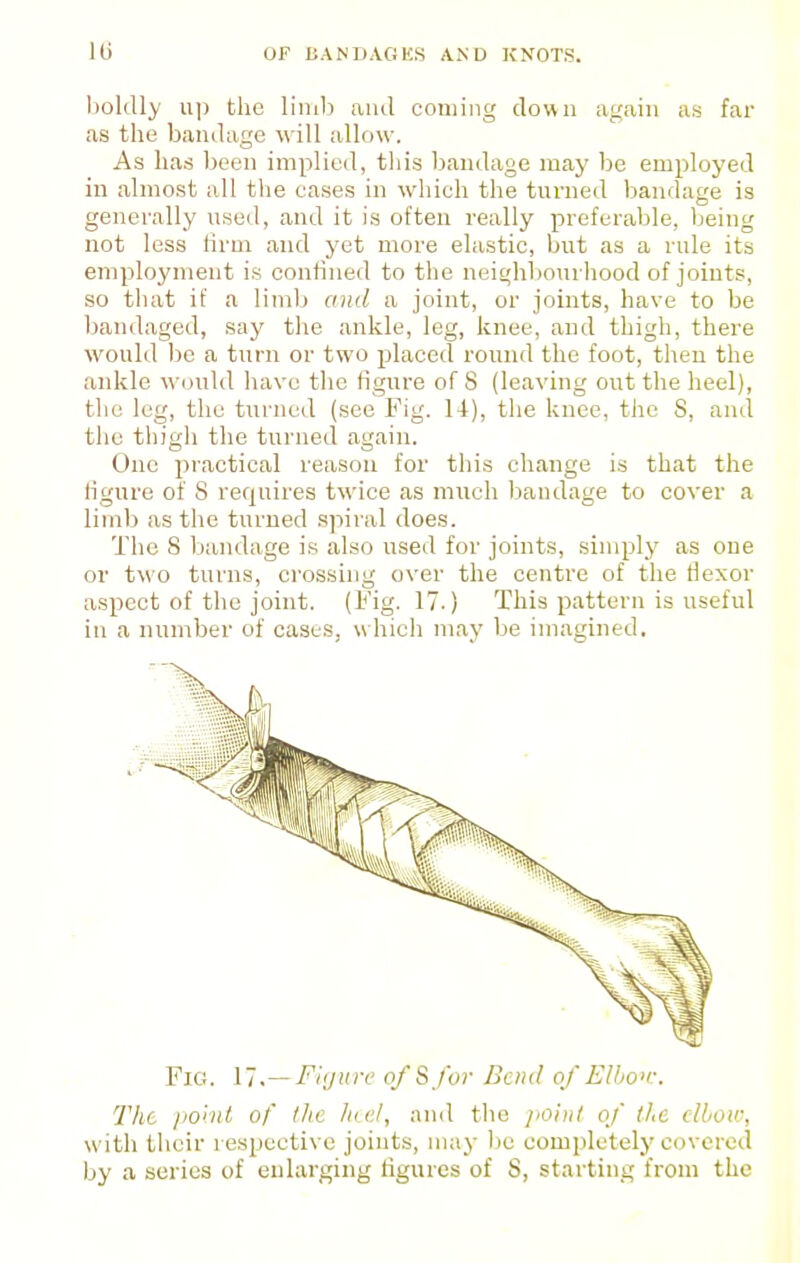 l)ol(Uy up the limb and coming clown again as far as the bamlage will allow. As has been implied, this bandage may be employed in almost all the eases in which the turned bandage is generally used, and it is often really preferable, being not less firm and yet more elastic, but as a rule its employment is confined to the neighbourhood of joints, so that if a limb and a joint, or joints, have to be bandaged, say the ankle, leg, knee, and thigh, there would l)e a turn or two 23laced round the foot, then the ankle would have the figure of S (leaving out the heel), the leg, the turned (see Fig. 14), tlie knee, the S, and the thigh the turned again. One practical reason for this change is that the figure of 8 requires twice as much Ijandage to cover a limb as the turned spiral does. The 8 bandage is also used for joints, simply as one or two turns, crossing over the centre of the flexor aspect of the joint. (Fig. 17.) This pattern is useful in a number of cases, w hich may be imagined. Fig. \~i .— Fi(jurc of S for Dcnd of Elhon-. The jio'iid of the hi el, and the jioiul of the elbow, with their respective joints, may be completely covered by a series of enlarging figures of S, starting from the