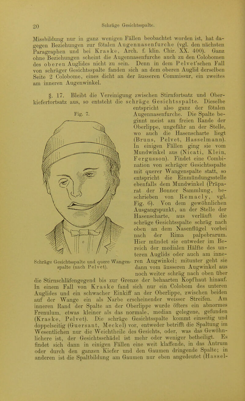 Missbildung nur in ganz wenigen Fällen beobachtet worden ist, hat da- gegen Beziehungen zur fötalen Augennasen furche (vgl. den nächsten Paragraphen und bei Kraske, Arch. f. Idin. Chir. XX. 400). Ganz ohne Beziehungen scheint die Augennasenfurche auch zu den Colobomen des ob eren Auglides nicht zu sein. Denn in dem Pelvet'schen Fall von schräger Gresichtsspalte fanden sich an dem oberen Auglid derselben Seite 2 Colobome, eines dicht an der äusseren Commissur, ein zweites am inneren Augenwinkel. §. 17. Bleibt die Vereinigung zwischen Stirnfortsatz und Ober- kieferfortsatz aus, so entsteht die schräge Gesichtsspalte. Dieselbe entspricht also ganz der fötalen Augennasenfurche. Die Spalte be- ginnt meist am freien Rande der Oberlippe, ungefähr an der Stelle, wo auch die Hasenscharte liegt (Bruns, Pelvet, Hasselmann). In einigen Fällen ging sie vom Mundwinkel aus (Nicati, Klein, Fergusson). Findet eine Combi- nation von schräger Gesichtsspalte mit querer Wangenspalte statt, so entspricht die Einmündungsstelle ebenfalls dem Mundwinkel (Präpa- rat der Bonner Sammlung, be- schrieben von Remacly, vgl. Fig. 6). Von dem gewöhnlichen Ausgangspunkt, an der Stelle der Hasenscharte, aus verläuft die schräge Gesichtsspalte schräg nach oben an dem Nasenflügel vorbei nach der Rima palpebrarum. Hier mündet sie entweder im Be- reich der medialen Hälfte des un- teren Auglids oder auch am inne- Schräge GesicMsspalte und quere Wangen- ren Augwinkel; mitunter geht sie spalte (nach Pelvet). dann vom äusseren Augwinkel aus noch weiter schräg nach oben über die Stirnschläfengegend bis zur Grenze der behaarten Kopfhaut hinauf. In einem Fall von Kraske fand sich nur ein Colobom des unteren Auglides und ein schwacher EinkifF an der Oberlippe, zwischen beiden auf der Wange ein als Narbe erscheinender weisser Streifen. Am inneren Rand der Spalte an der Oberlippe wurde öfters ein abnormes Frenulura, etwas kleiner als das normale, median gelegene, gefunden (Kraske, Pelvet). Die schräge Gesichtsspalte kommt einseitig und doppelseitig (Guersant, Meckel) vor, entweder betrifft die Spaltung im Wesentlichen nur die Weichtheile des Gesichts, oder, was das Gewöhn- lichere ist, der Gesichtsschädel ist mehr oder weniger betheiligt. Es findet sich dann in einigen Fällen eine weit klaffende, in das Antrum oder durch den ganzen Kiefer und den Gaumen dringende Spalte; in anderen ist die Spaltbildung am Gaumen nur eben angedeutet (Hassel- Fig. 7.