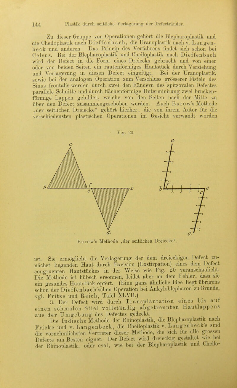 Zu dieser Gruppe von Operationen gehört die Blepliaroplastik und die Cheiloplastik nach Dieffenbach, die Uranoplastik nach v. Langen- beck und anderen. Das Princip des Verfahrens findet sich schon bei Celsus. Bei der Blepharoplastik und Cheiloplastik nach Dieffenbach wird der Defect in die Form eines Dreiecks gebracht und von einer oder von beiden Seiten ein rautenförmiges Hautstück durch Verziehung und Verlagerung in diesen Defect eingefügt. Bei der Uranoplastik, sowie bei der analogen Operation zum Verschluss grösserer Fisteln des Sinus frontalis werden durch zwei den Rändern des spitzovalen Defectes parallele Schnitte und durch flächenförmige Unterminkung zwei brücken- förmige Lappen gebildet, welche von den Seiten nach der Mitte zu über den Defect zusammengeschoben werden. Auch Burow's Methode „der seitlichen Dreiecke gehört hierher, die von ilu-em Autor für die verschiedensten plastischen Operationen im Gesicht verwandt worden Fig. 20. Burow's Methode „der seitlichen Dreiecke. ist. Sie ermöglicht die Verlagerung der dem dreieckigen Defect zu- nächst liegenden Haut durch Excision (Exstirpation) eines dem Defect congruenten Hautstückes in der Weise wie Fig. 20 veranschaulicht. Die°Methode ist hübsch ersonnen, leidet aber an dem Fehler, dass sie ein gesundes Hautstück opfert. (Eine ganz ähnliche Idee liegt übrigens schon der Dieffenbach'schen Operation bei Ankyloblepharon zu Grunde, vgl. Fritze und Reich, Tafel XLVH.) 3. Der Defect wird durch Transplantation eines bis auf einen schmalen Stiel vollständig abgetrennten Hautlappens aus der Umgebung des Defectes gedeckt. Die ludische Methode der Rhinoplastik, die Blepharoplastik nach Fricke und v. Langenbeck, die Cheiloplastik v. Langenbeck's sind die vornehmlichsten Vertreter dieser Methode, die sich für alle grossen Defecte am Besten eignet. Der Defect wird dreieckig gestaltet wie bei der Rhinoplastik, oder oval, wie bei der Blepharoplastik und Cheüo-