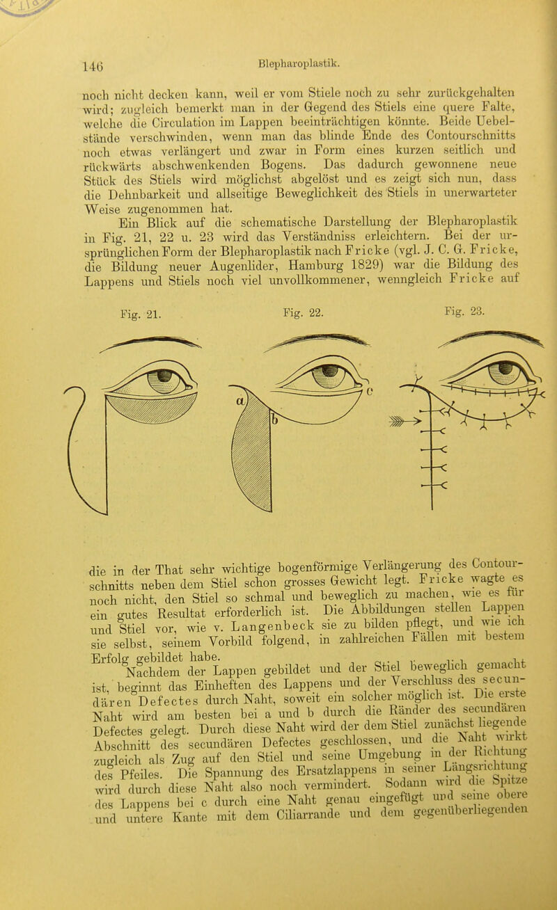 noch nicht decken kann, weil er vom Stiele noch zu sehr zurückgehalten wird; zugleich bemerkt man in der Gegend des Stiels eine quere Falte, welche die Circulation im Lappen beeinträchtigen könnte. Beide Uebel- stände verschwinden, wenn man das blinde Ende des Contourschnitts noch etwas verlängert und zwar in Form eines kurzen seitlich und rückwärts abschwenkenden Bogens. Das dadurch gewonnene neue Stück des Stiels wird möglichst abgelöst und es zeigt sich nun, dass die Dehnbarkeit und allseitige Beweglichkeit des Stiels in unerwarteter Weise zugenommen hat. Ein Blick auf die schematische Darstellung der Blepharoplastik in Fig. 21, 22 u. 23 wird das Verständniss erleichtern. Bei der ur- sprünglichen Fonn der Blepharoplastik nach Fricke (vgl. J. C. G. Fricke, die Bildung neuer Augenlider, Hamburg 1829) war die Bildung des Lappens und Stiels noch viel unvollkommener, wenngleich Fricke auf Fig. 21. . Kg. 22. Fig. 23. 4ie in der That sehr wichtige bogenförmige Verlängerung des Contour- schnitts neben dem Stiel schon grosses Gewicht legt. Fricke wagte es noch nicht, den Stiel so schmal und beweglich zu machen wie es tur ein o-utes Resultat erforderlich ist. Die Abbddungen steUen Lappen und Stiel vor, wie v. Langenbeck sie zu büden pflegt, ^^d wiych sie selbst, seinem Vorbild folgend, m zaUreichen Fallen mit bestem Erfolg gebildet habe. , v vi Nachdem der Lappen gebildet und der Stie beweghch gemacht ist, beginnt das Einheften des Lappens und der Verschluss des secu^^^^ dären Defectes durch Naht, soweit em solcher moghch ist. Dienste Naht wird am besten bei a und b durch die Ränder des secundaien Defectes gelegt. Durch diese Naht wird der dem Stiel zunächst hegende Abschnitt^ef secundären Defectes geschlossen, und .^^ ^ah wi^^^^^ zugleich als Zug auf den Stiel und seme Umgebung m dei Richtung def Pfeü;s. Dfe Spannung des Ersatzlappens in -mer Lang^nch^^^^ wird durch diese Naht also noch vermindert. Sodann wiid die Spitze deT Lappens bei c durch eine Naht genau eingefügt uud seine ob^-e und imtere Kante mit dem Ciliarrande und dem gegenüberliegenden