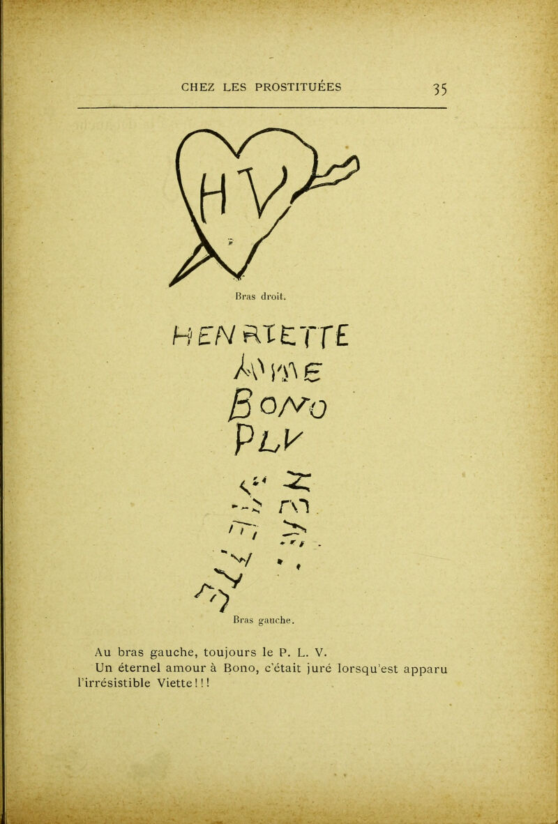 Bras droit. H EN RICTTE - > ro. Bras gauche. Au bras gauche, toujours le P. L. V. Un éternel amour à Bono, c'était juré lorsqu'est apparu l'irrésistible Viette!!!