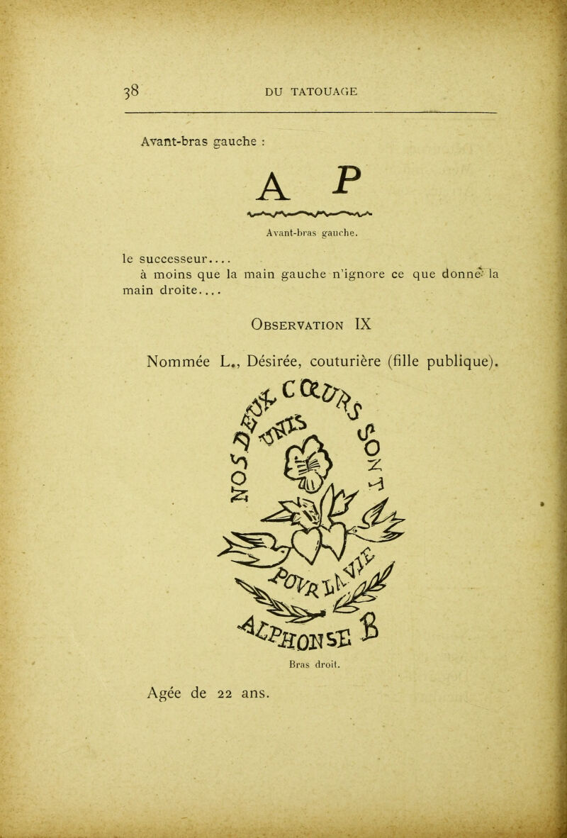 Avant-bras gauche A P Avant-bras gauche. le successeur à moins que la main gauche n'ignore ce que donne'' la main droite Observation IX Nommée L., Désirée, couturière (fille publique). Bras droit.