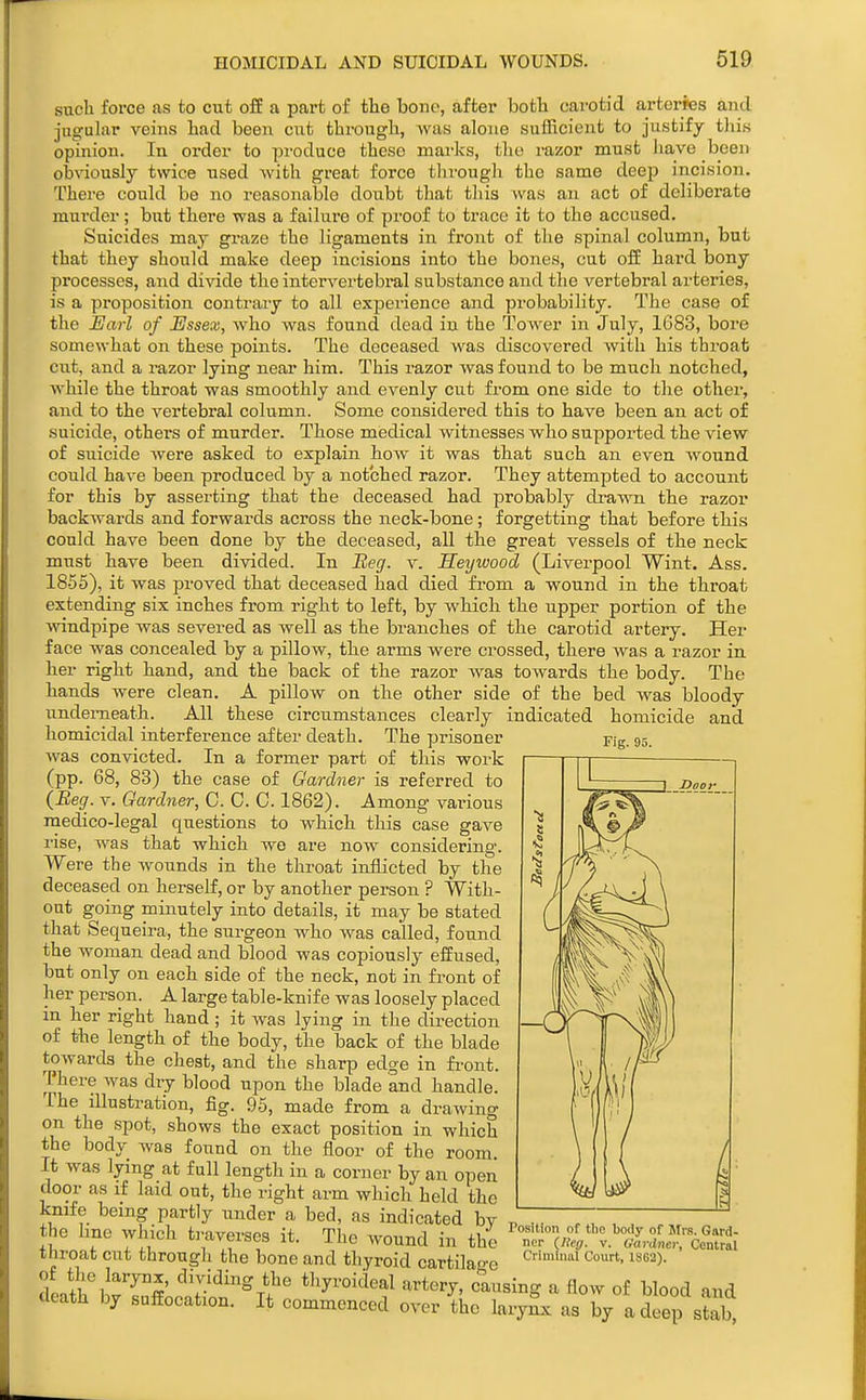 such force as to cut off a part o£ the bone, after botli carotid arteries and jugular veins had been cut through, was alone sufficient to justify this opinion. In order to produce these marks, the razor must have been obviously twice used Avith great force through the same deep incision. There could be no reasonable doubt that this was an act of deliberate murder; hut there was a failure of proof to trace it to the accused. Suicides may gi-aze the ligaments in front of the spinal column, but that they should make deep incisions into the bones, cut off hard bony processes, and divide the intervertebral substance and the vertebral arteries, is a proposition contrary to all experience and probability. The case of the JEJarl of Ussex, who was found dead in the Tower in July, 1683, bore somewhat on these points. The deceased was discovered with his throat cut, and a razor lying near him. This razor was found to be much notched, Avhile the throat was smoothly and evenly cut from one side to the othei, and to the vertebral column. Some considered this to have been an act of suicide, others of murder. Those medical witnesses who supported the view of suicide were asked to explain how it was that such an even Avound could have been produced by a notched razor. They attempted to account for this by asserting that the deceased had probably drawn the razor backwards and forwards across the neck-bone ; forgetting that before this could have been done by the deceased, all the great vessels of the neck must have been divided. In Beg. v. Heywood (Liverpool Wint. Ass. 1855), it was jiroved that deceased had died from a wound in the throat extending six inches from right to left, by which the upper portion of the windpipe was severed as well as the branches of the carotid artery. Her face was concealed by a pillow, the arms were crossed, there was a razor in her right hand, and the back of the razor was towards the body. The hands were clean. A pillow on the other side of the bed was bloody underneath. All these circumstances clearly indicated homicide and Fig. 95. homicidal interference after death. The prisoner was convicted. In a former part of this work (pp. 68, 83) the case of Gardner is referred to (Beg. V. Gardner, C. C. C. 1862). Among various medico-legal questions to which this case gave rise, was that which wo are now considering. Were the wounds in the throat inflicted by the deceased on herself, or by another person ? With- out going minutely into details, it may be stated that Sequeira, the surgeon who was called, found the woman dead and blood was copiously effused, but only on each side of the neck, not in front of her person. A large table-knife was loosely placed in her right hand ; it was lying in the direction of the length of the body, the back of the blade towards the chest, and the sharp edge in fi-ont. There was dry blood upon the blade and handle. The illustration, fig. 95, made from a drawing on the spot, shows the exact position in which the body was found on the floor of the room. It was lying at full length in a corner by an open door as if laid out, the right arm which held the knife being partly under a bed, as indicated by the line which traverses it. The wound in the throat cut through the bone and thyroid cartilage of «ie larynx, dividing the thyroideal artery, causing a flow of blood and death by suffocation. It commenced over the larySx as by a deep stab. Position of tlie body of Sirs. Gard- ner {Ueg. V. Gardner, Central Criminal Court, 18G2).