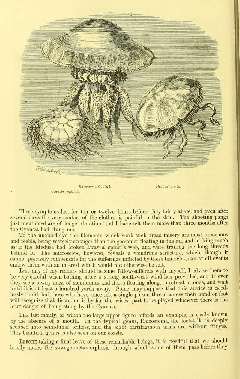 several days the very contact of the clothes is painful to the skin. The shooting pangs just mentioned are of longer duration, and I have felt them more than three months after the Cyansea had stung me. To the unaided eye the filaments which work such dread misery are most innocuous and feeble, being scarcely stronger than the gossamer floating in the air, and looking much as if the Medusa had broken away a spider's web, and were trailing the long threads behind it. The microscope, however, reveals a wondrous structure, which, though it cannot precisely compensate for the sufferings inflicted by these tentacles, can at all events endow them vsdth an interest which would not othei-wise be felt. Lest any of my readers should become fellow-sufferers with myself, I advise them to be very careful when bathing after a strong south-west wind has prevailed, and if ever they see a tawny mass of membranes and fibres floating along, to retreat at once, and wait until it is at least a hundred yards away. Some may suppose that this advice is need- lessly timid, but those who have once felt a single poison thread across their hand or foot will recognise that discretion is by far the wisest part to be played whenever there is the least danger of being stung by the Gyanaga. The last family, of which the large upper figure affords an example, is easily known by the absence of a mouth. In the typical genus, PJiizostoma, the footstalk is deeply scooped into semi-lunar orifices, and the eight cartilaginous arms are without fringes. This beautiful genus is also seen on our coasts. Before taking a final leave of these remarkable beings, it is needful that we should briefly notice the strange metamorphosis through which some of them pass before they