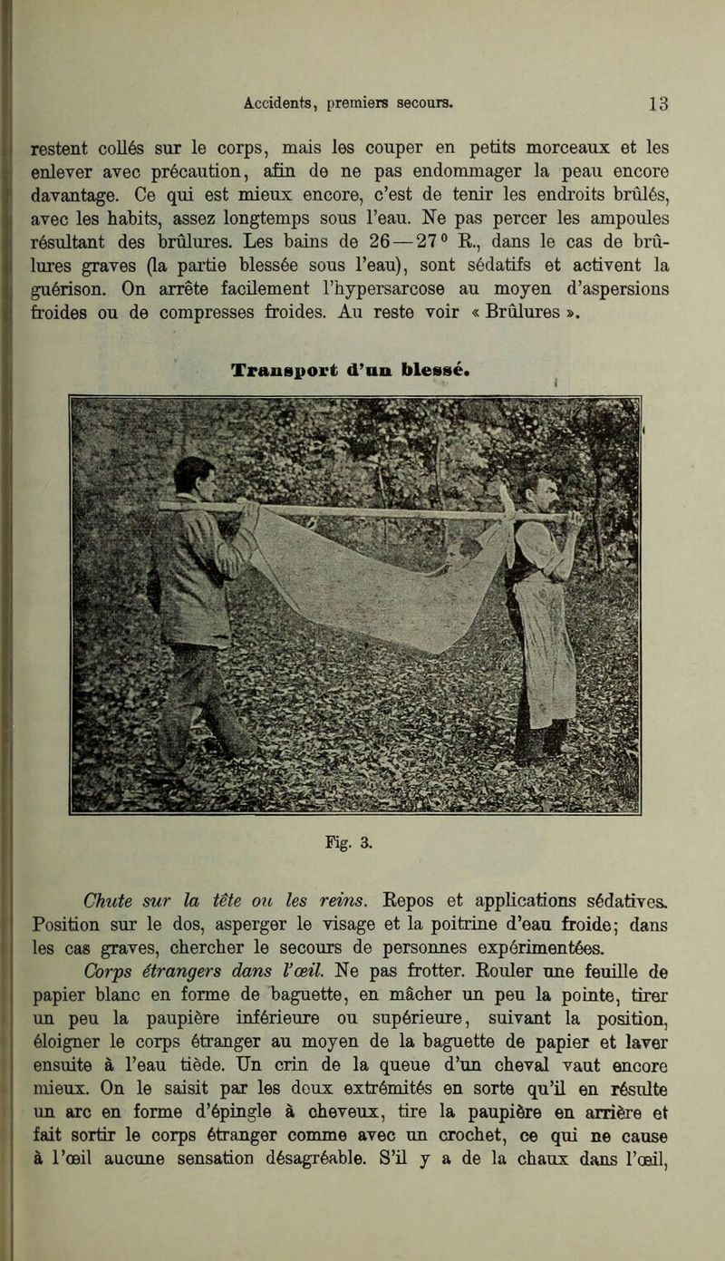 restent collés sur le corps, mais les couper en petits morceaux et les enlever avec précaution, afin de ne pas endommager la peau encore i davantage. Ce qui est mieux encore, c’est de tenir les endroits brûlés, Îavec les habits, assez longtemps sous l’eau. Ne pas percer les ampoules résultant des brûlures. Les bains de 26 — 27® R, dans le cas de brû- lures graves (la pai'tie blessée sous l’eau), sont sédatifs et activent la I guérison. On arrête facilement l’hypersarcose au moyen d’aspersions froides ou de compresses froides. Au reste voir « Brûlures ». Transport d’an, blessé. Fig. 3. Chute sur la tête ou les reins. Eepos et applications sédatives. Position sur le dos, asperger le visage et la poitrine d’eau froide; dans les cas graves, chercher le secours de personnes expérimentées. Corps étrangers dans l’œil. Ne pas frotter. Eouler une feuille de papier blanc en forme de baguette, en mâcher un peu la pointe, tirer un peu la paupière inférieure ou supérieure, suivant la position, éloigner le corps étranger au moyen de la baguette de papier et laver ensuite à l’eau tiède. Un crin de la queue d’un cheval vaut encore nûeux. On le saisit par les doux extrémités en sorte qu’ü en résulte un arc en forme d’épingle à cheveux, tire la paupière en arrière et ' fait sortir le corps étranger comme avec un crochet, ce qui ne cause i à l’œil aucune sensation désagréable. S’il y a de la chaux dans l’oedl. I