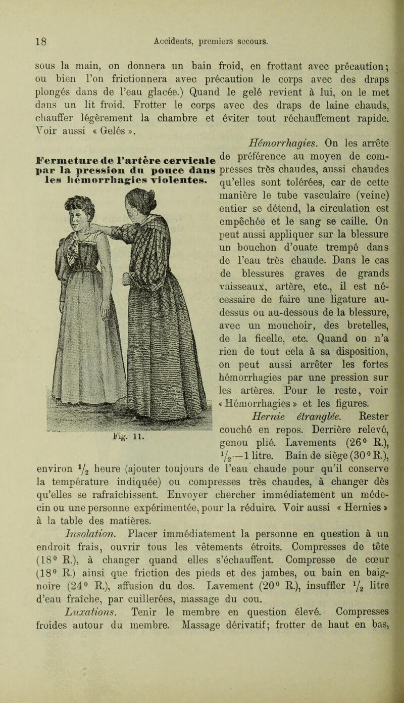 sous la main, on donnera un bain froid, en frottant avec précaution; ou bien l’on frictionnera avec précaution le corps avec des draps plongés dans de l’eau glacée.) Quand le gelé revient à lui, on le met dans un lit froid. Frotter le corps avec des draps de laine chauds, cliaufi'er légèrement la chambre et éviter tout réchauffement rapide. Voir aussi « Gelés ». Hémorrhagies. On les an’ête Fermeture de l’artère cervicale‘i® préférence au moyen de com- par la pression du ponce dans presses très chaudes, aussi chaudes les hémorrhas^ies violentes, qu’elles sont tolérées, car de cette manière le tube vasculaire (veine) entier se détend, la circulation est empêchée et le sang se caille. On peut aussi appliquer sur la blessui-e un bouchon d’ouate trempé dans de l’eau très chaude. Dans le cas de blessures graves de grands vaisseaux, artère, etc., il est né- cessaire de faire une ligature au- dessus ou au-dessous de la blessure, avec un mouchoir, des bretelles, de la ficelle, etc. Quand on n’a rien de tout cela à sa disposition, on peut aussi arrêter les fortes hémorrhagies par une pression sur les artères. Pour le reste, voir «Hémorrhagies» et les figures. Hernie étranglée. Rester couché en repos. Derrière relevé, genou plié. Lavements (26° R.), Y2—1 litre. Bain de siège (30 ° R.), environ Yj lieure (ajouter toujours de l’eau chaude pour qu’il conserve la température indiquée) ou compresses très chaudes, à changer dès qu’elles se rafraîchissent. Envoyer chercher immédiatement un méde- cin ou une personne expérimentée, pour la réduire. Voir aussi « Hernies » à la table des matières. Insolation. Placer immédiatement la personne en question à un endroit frais, ouvrir tous les vêtements étroits. Compresses de tête (18° R.), à changer quand elles s’échauffent. Compresse de cœur (18° R.) ainsi que friction des pieds et des jambes, ou bain en baig- noire (24° R.), afi'usion du dos. Lavement (20° R.), insuffler Y2 litre d’eau fraîche, par cuillerées, massage du cou. Luxations. Tenir le membre en question élevé. Compresses froides autour du membre. Massage dérivatif; frotter de haut en bas,