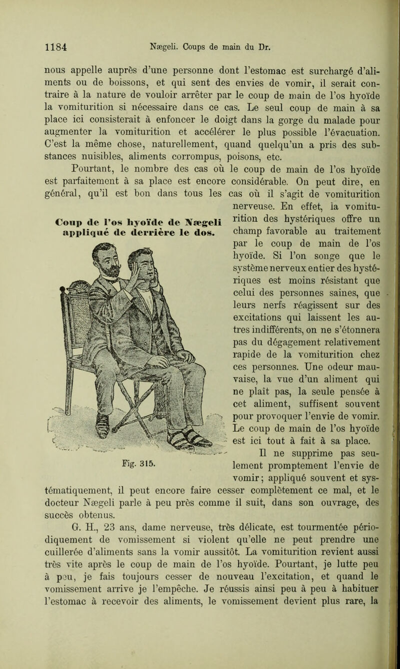 nous appelle auprès d’une personne dont l’estomac est surchargé d’ali- ments ou de boissons, et qui sent des envies de vomir, il serait con- traire à la nature de vouloir arrêter par le coup de main de l’os hyoïde la vomiturition si nécessaire dans ce cas. Le seul coup de main à sa place ici consisterait à enfoncer le doigt dans la gorge du malade pour augmenter la vomiturition et accélérer le plus possible l’évacuation. C’est la même chose, naturellement, quand quelqu’un a pris des sub- stances nuisibles, aliments corrompus, poisons, etc. Pourtant, le nombre des cas où le coup de main de l’os hyoïde est parfaitement à sa place est encore considérable. On peut dire, en général, qu’il est bon dans tous les cas où il s’agit de vomiturition nerveuse. En effet, ia vomitu- rition des hystériques offre un champ favorable au traitement par le coup de main de l’os hyoïde. Si l’on songe que le système nerveux entier des hysté- riques est moins résistant que celui des personnes saines, que leurs nerfs réagissent sur des excitations qui laissent les au- tres indifférents, on ne s’étonnera pas du dégagement relativement rapide de la vomiturition chez ces personnes. Une odeur mau- vaise, la vue d’un aliment qui ne plait pas, la seule pensée à cet aliment, suffisent souvent pour provoquer l’envie de vomir. Le coup de main de l’os hyoïde est ici tout à fait à sa place. Il ne supprime pas seu- lement promptement l’envie de vomir; appliqué souvent et sys- tématiquement, il peut encore faire cesser complètement ce mal, et le docteur Nægeli parle à peu près comme il suit, dans son ouvrage, des succès obtenus. G. H., 23 ans, dame nerveuse, très délicate, est tourmentée pério- diquement de vomissement si violent qu’elle ne peut prendre une cuillerée d’aliments sans la vomir aussitôt. La vomiturition revient aussi très vite après le coup de main de l’os hyoïde. Pourtant, je lutte peu à peu, je fais toujours cesser de nouveau l’excitation, et quand le vomissement arrive je l’empêche. Je réussis ainsi peu à peu à habituer l’estomac à recevoir des aliments, le vomissement devient plus rare, la Coup <le l’os hyoïde «le Sægeli appliqué de derrière le dos.