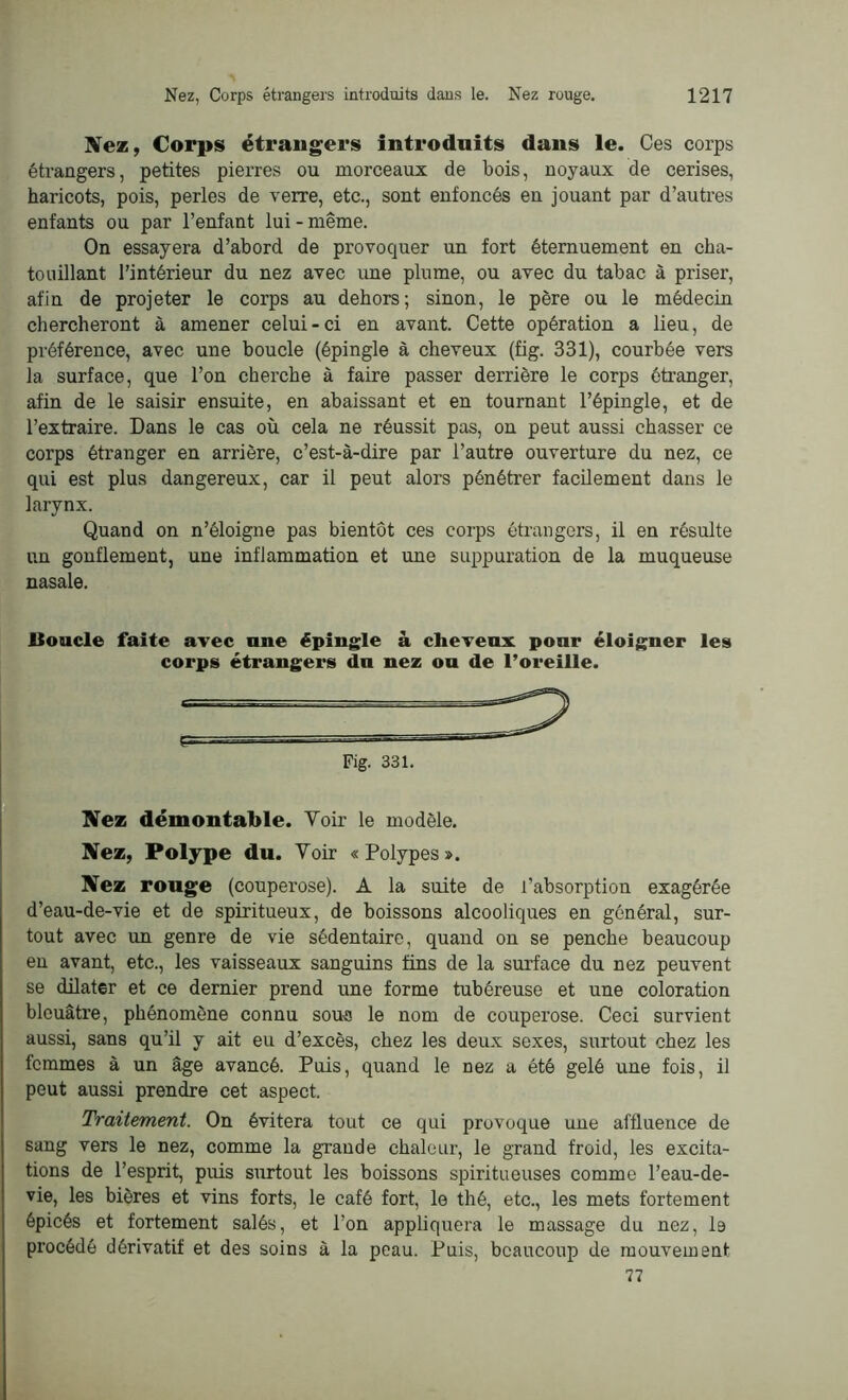 Nez, Corps étrangers introduits dans le. Ces corps étrangers, petites pierres ou morceaux de bois, noyaux de cerises, haricots, pois, perles de verre, etc., sont enfoncés en jouant par d’autres enfants ou par l’enfant lui - même. On essayera d’abord de provoquer un fort éternuement en cha- touillant l’intérieur du nez avec une plume, ou avec du tabac à priser, afin de projeter le corps au dehors; sinon, le père ou le médecin chercheront à amener celui - ci en avant. Cette opération a lieu, de préférence, avec une boucle (épingle à cheveux (fig. 331), courbée vers la surface, que l’on cherche à faire passer derrière le corps étranger, afin de le saisir ensuite, en abaissant et en tournant l’épingle, et de l’extraire. Dans le cas où cela ne réussit pas, on peut aussi chasser ce corps étranger en arrière, c’est-à-dire par l’autre ouverture du nez, ce qui est plus dangereux, car il peut alors pénétrer facilement dans le larynx. Quand on n’éloigne pas bientôt ces corps étrangers, il en résulte un gonflement, une inflammation et une suppuration de la muqueuse nasale. ISoucle faite avec nue épingle à cheveux pour éloigner les corps étrangers du nez ou de l’oreille. Fig. 331. Nez démontable. Voir le modèle. Nez, Polype du. Voir «Polypes». Nez rouge (couperose). A la suite de l'absorption exagérée d’eau-de-vie et de spiritueux, de boissons alcooliques en général, sur- tout avec un genre de vie sédentaire, quand on se penche beaucoup en avant, etc., les vaisseaux sanguins fins de la surface du nez peuvent se dilater et ce dernier prend une forme tubéreuse et une coloration bleuâtre, phénomène connu sou« le nom de couperose. Ceci survient aussi, sans qu’il y ait eu d’excès, chez les deux sexes, surtout chez les femmes à un âge avancé. Puis, quand le nez a été gelé une fois, il peut aussi prendre cet aspect. Traitement. On évitera tout ce qui provoque une affluence de sang vers le nez, comme la grande chaleur, le grand froid, les excita- tions de l’esprit, puis surtout les boissons spiritueuses comme l’eau-de- vie, les bières et vins forts, le café fort, le thé, etc., les mets fortement épicés et fortement salés, et l’on appliquera le massage du nez, 19 procédé dérivatif et des soins à la peau. Puis, beaucoup de mouvement 77