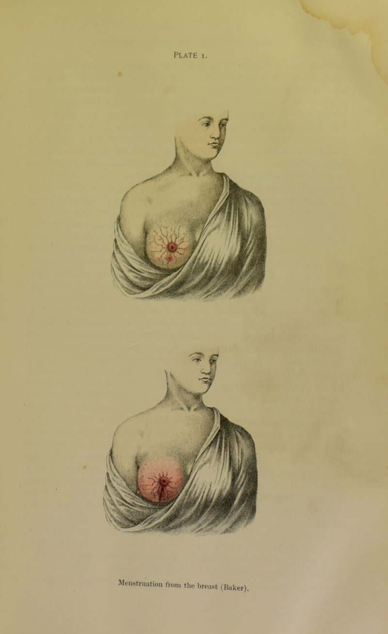 Menstruation from the breast (Baker).