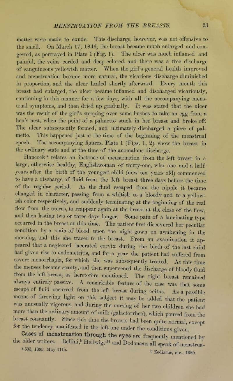 matter were made to exude. This discharge, however, was not offensive to the smell. On March 17, 1846, the breast became much enlarged and con- gested, as portrayed in Plate 1 (Fig. 1). The ulcer was much inflamed and painful, the veins corded and deep colored, and there was a free discharge of sanguineous yellowish matter. When the girl's general health improved and menstruation became more natural, the vicarious discharge diminished in proportion, and the ulcer healed shortly afterward. Every month this breast had enlarged, the ulcer became inflamed and discharged vicariously, continuing in this manner for a few days, with all the accompanying mens- trual symptoms, and then dried up gradually. It was stated that the ulcer was the result of the girl's stooping over some bushes to take an egg from a hen's nest, when the point of a palmetto stuck in her breast and broke off. The ulcer subsequently formed, and ultimately discharged a piece of pal- metto. This happened just at the time of the beginning of the menstrual epoch. The accompanying figures, Plate 1 (Figs. 1, 2), show the breast in the ordinary state and at the time of the anomalous discharge. Hancock * relates an instance of menstruation from the left breast in a large, otherwise healthy. Englishwoman of thirty-one, who one and a half years after the birth of the youngest child (now ten years old) commenced to have a discharge of fluid from the left breast three days before the time of the regular period. As the fluid escaped from the nipple it became changed in character, passing from a whitish to a bloody and to a yellow- ish color respectively, and suddenly terminating at the beginning of the real flow from the uterus, to reappear again at the breast at the close of the flow, and then lasting two or three days longer. Some pain of a lancinating type occurred in the breast at this time. The patient first discovered her peculiar condition by a stain of blood upon the night-gown on awakening in the morning, and this she traced to the breast. From an examination it ap- peared that a neglected lacerated cervix during the birth of the last child had given rise to endometritis, and for a year the patient had suffered from severe menorrhagia, for which she was subsequently treated. At this time the menses became scanty, and then supervened the discharge of bloody fluid from the left breast, as heretofore mentioned. The right breast remained always entirely passive. A remarkable feature of the case was that some escape of fluid occurred from the left breast during coitus. As a possible means of throwing light on this subject it may be added that the patient was unusually vigorous, and during the nursing of her two children she had more than the ordinary amount of milk (galactorrhea), which poured from the breast constantly. Since this time the breasts had been quite normal, except for the tendency manifested in the left one under the conditions given Cases of menstruation through the eyes are frequently mentioned by the older writers. Bellini,'^ Hellwig,^i^ and Dodon^us all speak of menstrua- 1533, 1895, May 11th. . „ ' ^ Zodiacus, etc., 1680.