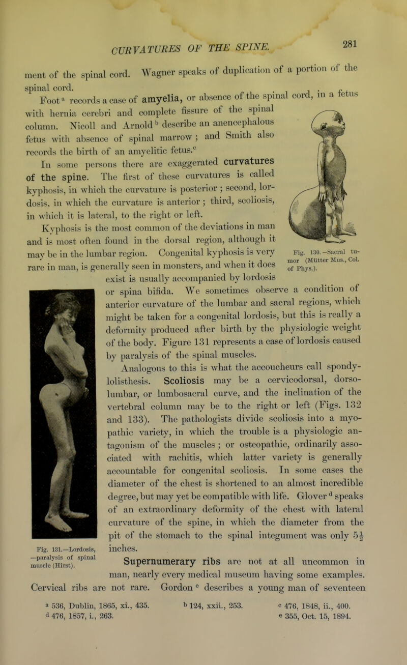 CURVATURES OF THE SPINE. Fig. i;su.—Sacral tu- mor (Mutter Mus., Col. of Phys.). mcnt of the spinal cord. Wagner speaks of duplication of a portion of the spinal cord. , „ Foot'^ records a case of amyelia, or absence of the spinal cord, in a tetus with hernia cerebri and complete fissure of the spinal column. Nicoll and Arnold ^ describe an anencephalous fetus with absence of spinal marrow ; and Smith also records the birth of an amyelitic fetus.^ In some persons there are exaggerated curvatures of the spine. The first of these curvatures is called kyphosis, in wliich the curvature is posterior ; second, lor- dosis, in which the curvature is anterior; third, scoliosis, in which it is lateral, to the right or left. Kyphosis is the most common of the deviations in man and is most often found in the dorsal region, althougli it may be in the lumbar region. Congenital kyphosis is very rare in man, is generally seen in monsters, and when it does exist is usually accompanied by lordosis or spina bifida. We sometimes observe a condition of anterior curvature of the lumbar and sacral regions, which midit be taken for a congenital lordosis, but this is really a deformity produced after birth by the physiologic weight of the body. Figure 131 represents a case of lordosis caused by paralysis of the spinal muscles. Analogous to this is what the accoucheurs call spondy- lolisthesis. Scoliosis may be a cervicodorsal, dorso- lumbar, or lumbosacral curve, and the inclination of the vertebral column may be to the right or left (Figs. 132 and 133). The pathologists divide scoliosis into a myo- pathic variety, in which the trouble is a physiologic an- tagonism of the muscles ; or osteopathic, ordinarily asso- ciated with rachitis, which latter variety is generally accountable for congenital scoliosis. In some cases the diameter of the chest is shortened to an almost incredible degree, but may yet be compatible with life. Glover speaks of an extraordinary deformity of the chest with lateral curvature of the spine, in which the diameter from the pit of the stomach to the spinal integument was only 5| inches. Supernumerary ribs are not at all uncommon in man, nearly every medical museum having some examples. Cervical ribs are not rare. Gordon ® describes a young man of seventeen Fig. 131.—Lordosis, —paralysis of spinal muscle (Hirst). a 536, Dublin, 1865, xi., 435. d476, 1857, i., 263. 1124, xxii., 253. c 476, 1848, ii., 400. e 355, Oct. 15, 1894.