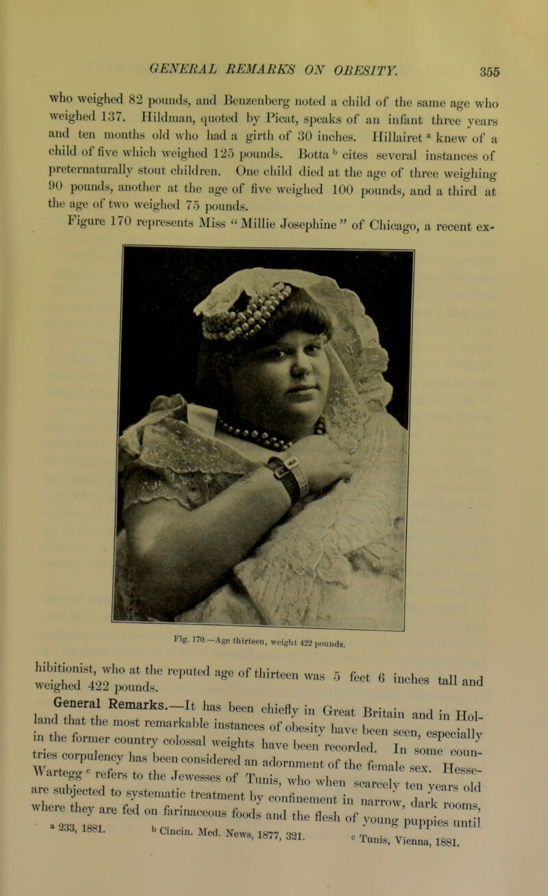 GENERAL REMARKS ON OBESITY. who weighed 82 pounds, and Benzenberg noted a cJiild of the same age who weighed 137. Hildman, quoted by Picat, speaks of an infant three years and ten months old who had a girth of 30 inches. HilJairetknew of a child of five which weighed 125 pounds. Botta cites several instances of preternaturally stout children. One child died at the age of three weighing 90 pounds, another at the age of five weighed 100 pounds, and a third at the age of two weighed 75 pounds. Figure 170 represents Miss Millie Josephine of Chicago, a recent ex- Fig. 170.—Age thirteen, weight 422 pounds. wSTd ^I'lr^^^^ ' « i-Hes tan and General Remarks.-It has been chiefly in Great Britain and in Hoi land that the most remarkable instances of obesity have been seen eslklt n the former country colossal weights have been recorded. In tme ^ tr es corpulency has been considered an adornment of the female Z i^srtedtr^^^^^^^^^^^ where they are fed on farinaceous JZZ^:;^:^^ ^, isei. . c,„c,n. Med. News, 18,7. 321.