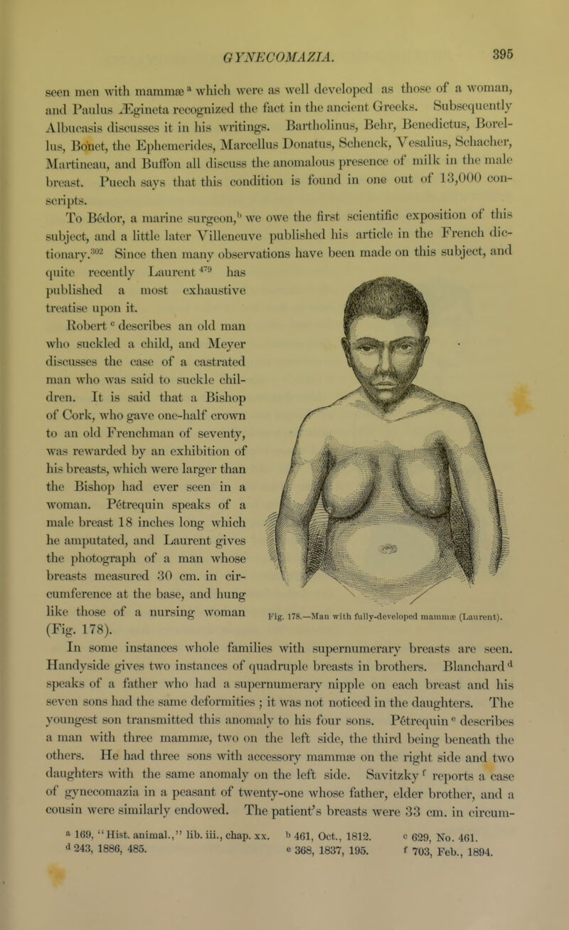 GYNECOMAZIA. seen men with mammae ^ which were as well developed as those of a woman, and Paulus ^Egineta recognized the fact in the ancient Greeks. Subsequently Albucasis discusses it in his writings. Bartholinus, Behr, Benedictus, Borel- lus, Bdnet, the Ephemerides, Marcellus Donatus, Schenck, Vesalius, Schacher, Martineau, and Buifon all discuss the anomalous presence of milk in the male breast. Puech says that tliis condition is found in one out of 13,000 con- scripts. To Bedor, a marine surgeon,*^ we owe the first scientific exposition of this subject, and a little later Villeneuve published his article in the French dic- tionary.^'^^ gj^^e then many observations have been made on this subject, and quite recently Laurent ^'^ has published a most exhaustive treatise upon it. Robert ^ describes an old man who suckled a child, and Meyer discusses the case of a castrated man who was said to suckle chil- dren. It is said that a Bishop of Cork, who gave one-half crown to an old Frenchman of seventy, was rewarded by an exhibition of his breasts, which were larger than the Bishop had ever seen in a woman. Petrequin speaks of a male breast 18 inches long which he amputated, and Laurent gives the photograph of a man whose breasts measured 30 cm. in cir- cumference at the base, and hung like those of a nursing woman (Fig. 178). In some instances whole families with supernumerary breasts are seen. Handyside gives two instances of quadruple breasts in brothers. Blanchard ^ speaks of a father who had a supernumerary nipple on each breast and his seven sons had the same deformities ; it was not noticed in the daughters. The youngest son transmitted this anomaly to his four sons. Petrequin « describes a man with three mammae, two on the left side, the third being beneath the others. He had three sons with accessory mammae on the right side and two daughters with the same anomaly on the left side. Savitzky reports a case of gynecomazia in a peasant of twenty-one whose father, elder brother, and a cousin were similarly endowed. The patient's breasts were 33 cm. in circum- a 169, Hist, animal., lib. ill., chap. xx. h 451, Oct., 1812. c 629, No. 461. d 243, 1886, 485. e 368, 1837, 195. f 703, Feb., 1894. Fig. 178.—Man with fully-developed mammae (Laurent).