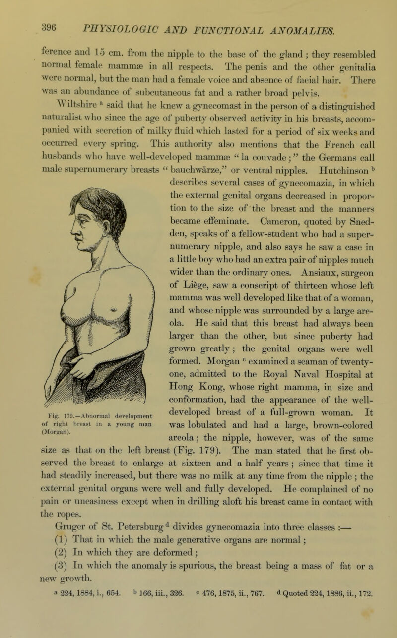 ference and 15 cm. from the nipple to the base of the gland; they resembled normal female mammae in all respects. The penis and the other genitalia were normal, but the man had a female voice and absence of facial hair. There was an abundance of subcutaneous fat and a rather broad pelvis. A\ iltshire * said that he knew a gynecomast in the person of a distinguished naturalist who since the age of puberty observed activity in his breasts, accom- panied with secretion of milky fluid which lasted for a period of six weeks and occurred every spring. This authority also mentions that the French call husbands who have well-developed mammae  la couvade; the Germans call male supernumerary breasts  bauchwarze/' or ventral nipples. Hutchinson ^ describes several cases of gynecomazia, in which the external genital organs decreased in propor- tion to the size of' the breast and the manners became effeminate. Cameron, quoted by Sned- den, speaks of a fellow-student who had a super- numerary nipple, and also says he saw a case in a little boy who had an extra pair of nipples much wider than the ordinary ones. Ansiaux, surgeon of Li^ge, saw a conscript of thirteen whose left mamma was well developed like that of a M^oman, and whose nipple was surrounded by a large are- ola. He said that this breast had always been larger than the other, but since puberty had grown greatly; the genital organs were well formed. Morgan ^ examined a seaman of twenty- one, admitted to the Royal Naval Hospital at Hong Kong, whose right mamma, in size and conformation, had the appearance of the well- Fig. 179.-Ahnormal development dcVclopcd brcast of a full-grOWU WOmaU. It of right breast in a young man was lobulatcd and had a large, brown-colored areola; the nipple, however, was of the same size as that on the left breast (Fig. 179). The man stated that he first ob- served the breast to enlarge at sixteen and a half years ; since that time it had steadily increased, but there was no milk at any time from the nipple ; the external genital organs were well and fully developed. He complained of no pain or uneasiness except when in drilling aloft his breast came in contact with the ropes. Gruger of St. Petersburg^ divides gynecomazia into three classes :— (1) That in which the male generative organs are normal; (2) In which they are deformed ; (3) In which the anomaly is spurious, the breast being a mass of fat or a new growth. a 224,1884, i., 654. ^ J 66, iii., 326. c 476,1875, ii., 767. d Quoted 224,1886, ii., 172.