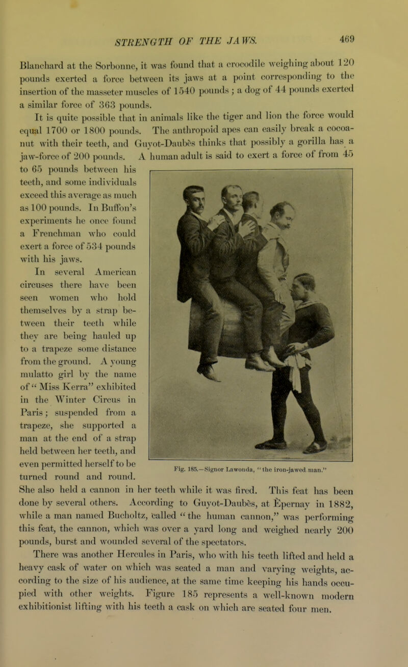 STRENGTH OF THE JAWS. Blanchard at the Sorbonne, it was found that a crocodile weighin^r about 120 pounds exerted a force between its jaws at a point corrcspontling to the insertion of the masseter muscles of 1540 pounds ; a dog of 44 pounds exerted a similar force of 363 pounds. It is quite possible that in animals like the tiger and lion the force would equal 1700 or 1800 pounds. The anthropoid apes can easily break a cocoa- nut with their teeth, and Guyot-Daubos thinks that possibly a gorilla has a jaw-force of 200 pounds. A human adult is said to exert a force of from 45 to 65 pounds between his teeth, and some individuals exceed this average as nuich as 100 pounds. In Buffon's experiments he onco found a Frenchman who could exert a force of 534 pounds with his jaws. In several American circuses there have been seen women who hold themselves by a strap be- tween their teeth while they are being hauled up to a trapeze some distance from the ground. A young mulatto girl by the name of  Miss Kerra exhibited in the Winter Circus in Paris; suspended from a trapeze, she supported a man at the end of a strap held between her teeth, and even permitted herself to be turned round and round. She also held a cannon in her teeth while it was fired. This feat has been done by several others. According to Guyot-Daub6s, at fipernay in 1882, while a man named Bucholtz, called  the human cannon, was performing this feat, the cannon, which was over a yard long and weighed nearly 200 pounds, burst and wounded several of the s{)ectators. There was another Hercules in Paris, who with his teeth lifted and held a heavy cask of water on which was seated a man and varying weights, ac- cording to the size of his audience, at the same time keeping his hands occu- pied with other weights. Figure 185 represents a well-known modern exhibitionist lifting with his teeth a cask on which are seated four men. Fig. 185.—Signor Lawoiida, '• the iron-jawed man.