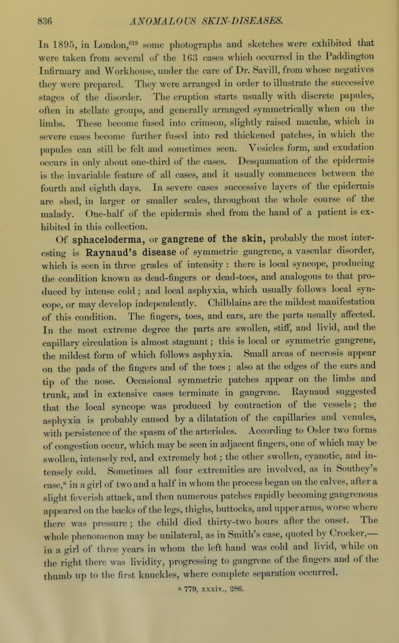 In 1895, in London/*^ some photographs and sketches were exhibited that were taken from several of the 163 cases which occurred in the Paddington Infirmary and Workhouse, under the care of Dr. Savill, from whose negatives they were prepared. They were arranged in order to ilkistrate the successive stages of the disorder. The eruption starts usually with discrete papules, often in stellate groups, and generally arranged symmetrically when on the limbs. These become fused into crimson, slightly raised maculae, which in severe cases become further fused into red thickened patches, in which the papules can still be felt and sometimes seen. Vesicles form, and exudation occurs in only about one-third of the cases. Desquamation of the epidermis is the invariable feature of all cases, and it usually commences between the fourth and eighth days. In severe cases successive layers of the epidermis are shed, in larger or smaller scales, throughout the whole course of the malady. One-half of the epidermis shed from the hand of a patient is ex- hibited in this collection. Of sphaceloderma, or gangrene of the skin, probably the most inter- esting is Raynaud's disease of symmetric gangrene, a vascular disorder, which is seen in three grades of intensity : there is local syncope, producing the condition known as dead-fingers or dead-toes, and analogous to that pro- duced by intense cold ; and local asphyxia, which usually follows local syn- cope, or may develop independently. Chilblains are the mildest manifestation of this condition. The fingers, toes, and ears, are the parts usually affected. In the most extreme degree the parts are swollen, stifiP, and livid, and the capillary circulation is almost stagnant; this is local or symmetric gangrene, the mildest form of which follows asphyxia. Small areas of necrosis appear on the pads of the fingers and of the toes ; also at the edges of the ears and tip of the nose. Occasional symmetric patches appear on the limbs and trunk, and in extensive cases terminate in gangrene. Raynaud suggested that the local syncope was produced by contraction of the vessels; the asphyxia is probably caused by a dilatation of the capillaries and venules, with persistence of the spasm of the arterioles. According to Osier two forms of congestion occur, which may be seen in adjacent fingers, one of which may be swollen, intensely red, and extremely hot; the other swollen, cyanotic, and in- tensely cold. Sometimes all four extremities are involved, as in Southey's case,* in a girl of two and a half in whom the process began on the calves, after a slight feverish attack, and then numerous patches rapidly becoming gangrenous appeared on the backs of the legs, thighs, buttocks, and upper arms, worse where there was pressure ; the child died thirty-two hours after the onset. The whole phenomenon may be unilateral, as in Smith's case, quoted by Crocker,— in a girl of three years in whom the left hand was cold and livid, while on the right there was lividity, progressing to gangrene of the fingers and of the thumb up to the first knuckles, where complete separation occurred. a 779, xxxiv., 286.