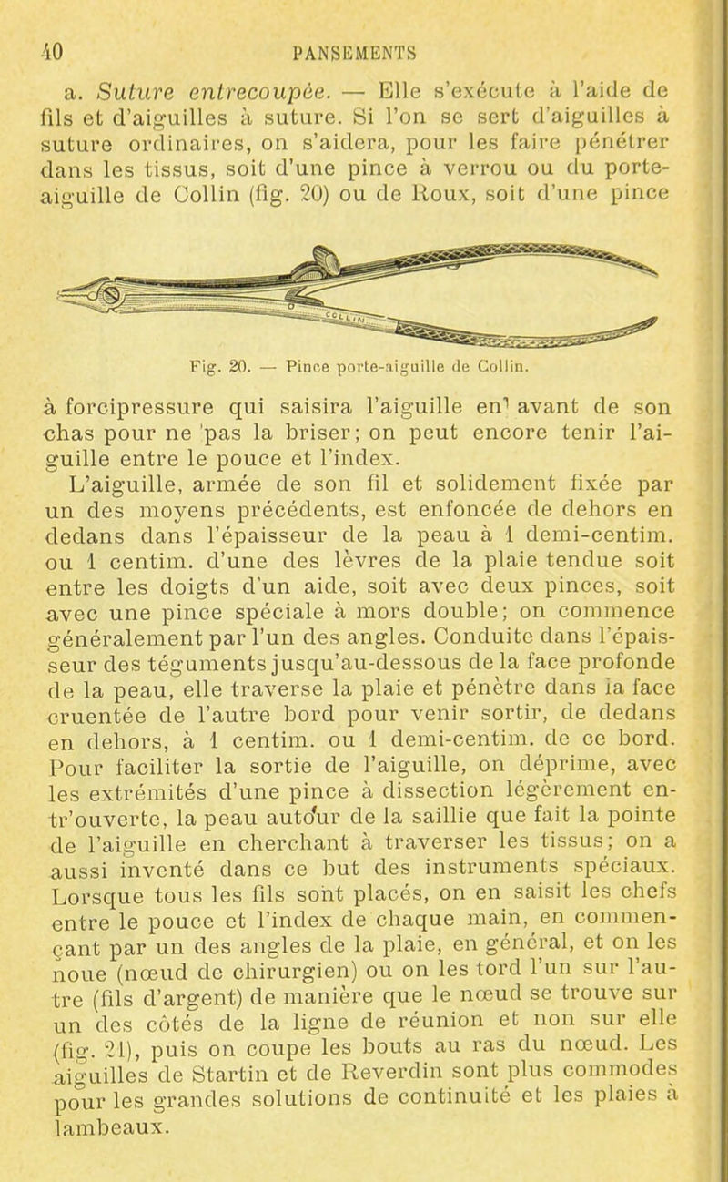 -40 PANSEMENTS a. Suture entrecoupée. — Elle s'exécute à l'aide de fils et d'aiguilles à suture. Si l'on se sert d'aiguilles à suture ordinaires, on s'aidera, pour les faire pénétrer dans les tissus, soit d'une pince à verrou ou du porte- aiguille de Oollin (fig. 20) ou de Roux, soit d'une pince Fig. 20. —■ Pince porte-:iiguille de Collin. à forcipressure qui saisira l'aiguille en'' avant de son chas pour ne 'pas la briser; on peut encore tenir l'ai- guille entre le pouce et l'index. L'aiguille, armée de son fil et solidement fixée par un des moyens précédents, est enfoncée de dehors en dedans dans l'épaisseur de la peau à 1 demi-centim. ou 1 centim. d'une des lèvres de la plaie tendue soit entre les doigts d'un aide, soit avec deux pinces, soit avec une pince spéciale à mors double; on commence généralement par l'un des angles. Conduite dans l'épais- seur des téguments jusqu'au-dessous delà face profonde de la peau, elle traverse la plaie et pénètre dans ia face cruentée de l'autre bord pour venir sortir, de dedans en dehors, à 1 centim. ou 1 demi-centim. de ce bord. Pour faciliter la sortie de l'aiguille, on déprime, avec les extrémités d'une pince à dissection légèrement en- tr'ouverte, la peau auto'ur de la saillie que fait la pointe de l'aiguille en cherchant à traverser les tissus; on a aussi inventé dans ce but des instruments spéciaux. Lorsque tous les fils sont placés, on en saisit les chefs entre le pouce et l'index de chaque main, en commen- çant par un des angles de la plaie, en général, et on les noue (nœud de chirurgien) ou on les tord l'un sur l'au- tre (fils d'argent) de manière que le nœud se trouve sur un des côtés de la ligne de réunion et non sur elle (fig. 21), puis on coupe les bouts au ras du nœud. Les aiguilles de Startin et de Reverdin sont plus commodes pour les grandes solutions de continuité et les plaies à lambeaux.