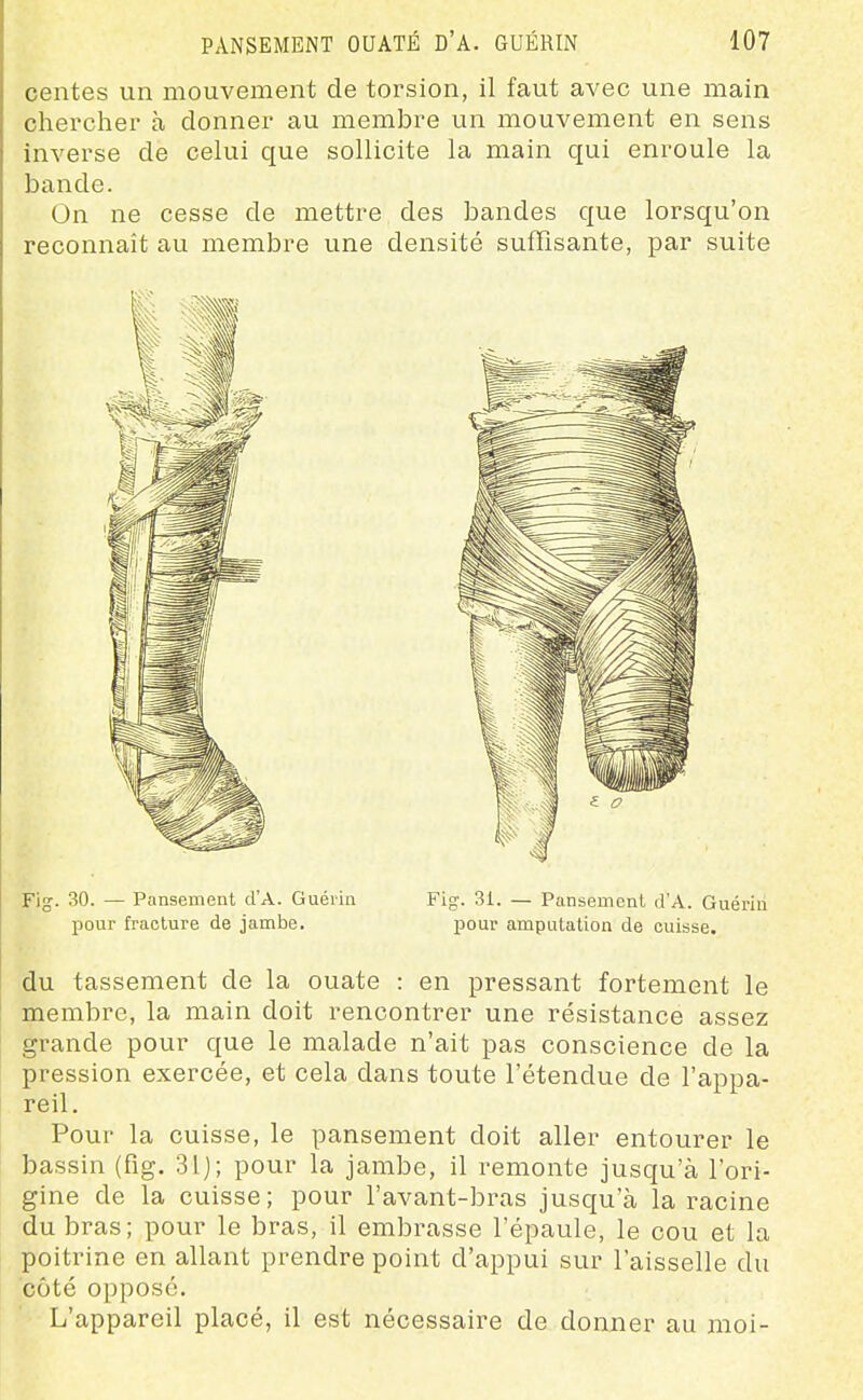 centes un mouvement de torsion, il faut avec une main chercher à donner au membre un mouvement en sens inverse de celui que sollicite la main qui enroule la bande. On ne cesse de mettre des bandes que lorsqu'on reconnaît au membre une densité suffisante, par suite Fig. 30. — Pansement d'A. Guéiin Fig. 31. — Pansement d'A. Guériu pour fracture de jambe. pour amputation de cuisse. du tassement de la ouate : en pressant fortement le membre, la main doit rencontrer une résistance assez grande pour que le malade n'ait pas conscience de la pression exercée, et cela dans toute l'étendue de l'appa- reil. Pour la cuisse, le pansement doit aller entourer le bassin (fig. 31 j; pour la jambe, il remonte jusqu'à l'ori- gine de la cuisse; pour l'avant-bras jusqu'à la racine du bras; pour le bras, il embrasse l'épaule, le cou et la poitrine en allant prendre point d'appui sur l'aisselle du côté opposé. L'appareil placé, il est nécessaire de donner au moi-