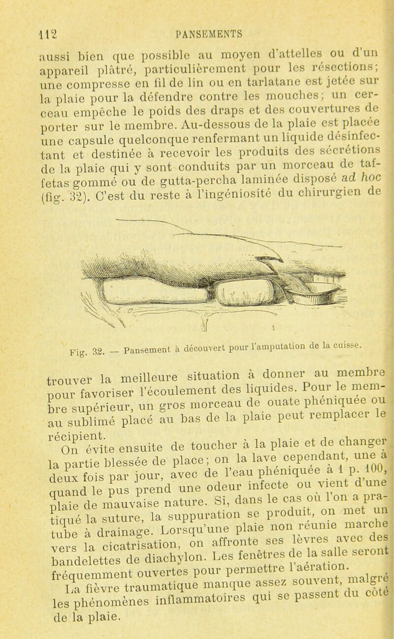 iiussi bien que possible au moyen d'attelles ou d'un appareil plâtré, particulièrement pour les résections; une compresse en fil de lin ou en tarlatane est jetée sur la plaie pour la défendre contre les mouclies; un cer- ceau empêche le poids des draps et des couvertures de porter sur le membre. Au-dessous de la plaie est placée une capsule quelconque renfermant un liquide désinfec- tant et destinée à recevoir les produits des sécrétions de la plaie qui y sont condxiits par un morceau de taf- fetas gommé ou de gutta-percha laminée disposé ad hoc (fig. 32). C'est du reste à l'ingéniosité du chirurgien de Fig. 32. - Pansement à découvert pour l'amputation de la cuisse. trouver la meilleure situation à donner au membre pour favoriser l'écoulement des liquides. Pour le mem- bre supérieur, un gros morceau de ouate pheniquee ou au s Jlimé placé au bas de la plaie peut remplacer le 'Sn évite ensuite de toucher à la plaie et de changer la partie blessée de place; on la lave cependant, une a âÀx fois par iour, avec de l'eau pheniquee a 1 p. lOU, qua^d le pus prend une odeur infecte ou vient d'une S de n?auvaise nature. Si, dans le cas ou 1 on a pra- fréquemment ouvertes pour permettre ^ ^J^^^^^' ^ . • La fièvre traumatique manque assez souvent, malg c les phénomènes inflammatoires qui se passent du coU de la plaie.