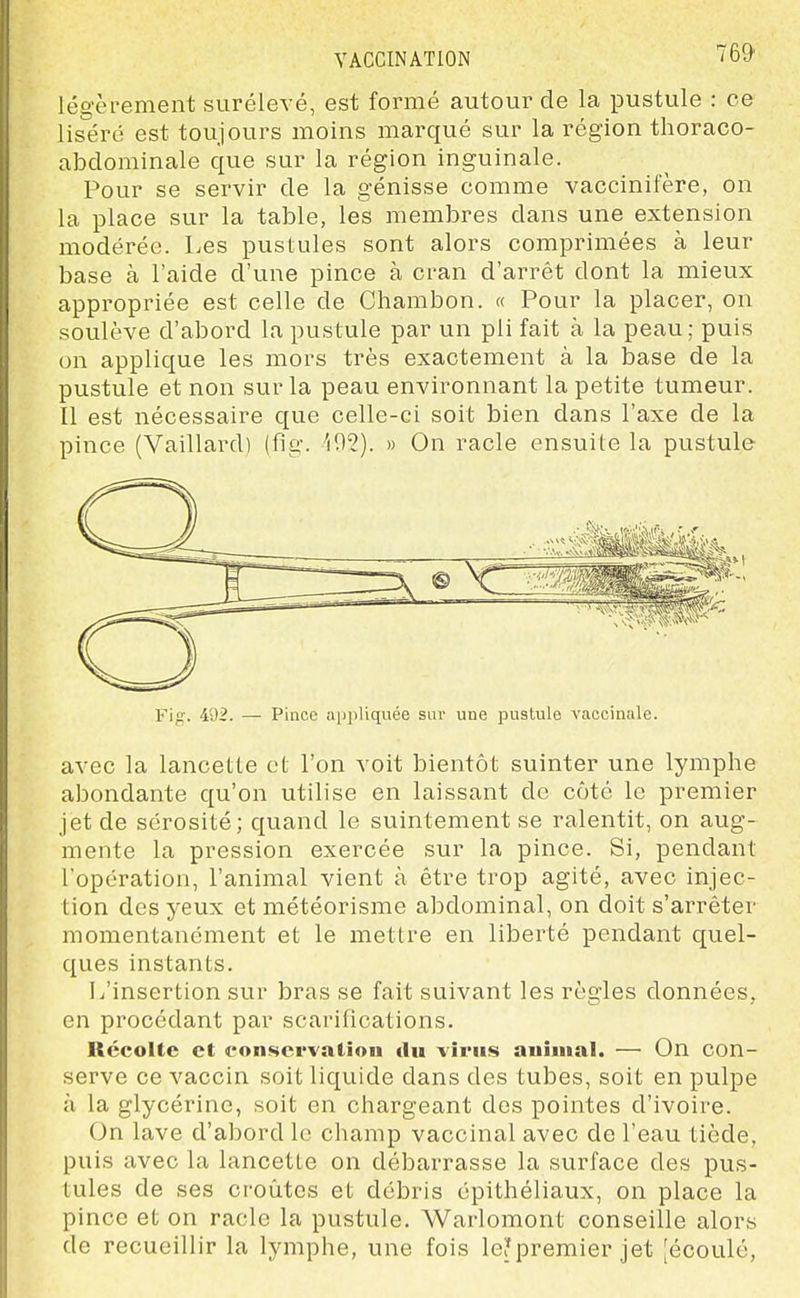 76D légèrement surélevé, est formé autour de la pustule : ce liséré est toujours moins marqué sur la région thoraco- abdominale que sur la région inguinale. Pour se servir de la génisse comme vaccinifère, on la place sur la table, les membres dans une extension modérée. Les pustules sont alors comprimées à leur base à l'aide d'une pince à cran d'arrêt dont la mieux appropriée est celle de Chambon. « Pour la placer, on soulève d'abord la pustule par un pli fait à la peau; puis on applique les mors très exactement à la base de la pustule et non sur la peau environnant la petite tumeur. Il est nécessaire que celle-ci soit bien dans l'axe de la pince (Vaillard) (fig. 492). » On racle ensuite la pustule Fig. 492. —• Pince apiiliquée sur une pustule vaccinale. avec la lancette et l'on voit bientôt suinter une lymphe abondante qu'on utilise en laissant de côté le premier jet de sérosité; quand le suintement se ralentit, on aug- mente la pression exercée sur la pince. Si, pendant l'opération, l'animal vient à être trop agité, avec injec- tion des yeux et météorisme abdominal, on doit s'arrêter momentanément et le mettre en liberté pendant quel- ques instants. 1/insertion sur bras se fait suivant les règles données, en procédant par scarilications. Récolte et conservation du virus animal. — On con- serve ce vaccin soit liquide dans des tubes, soit en pulpe à la glycérine, soit en chargeant dos pointes d'ivoire. On lave d'abord le champ vaccinal avec de l'eau tiède, puis avec la lancette on débarrasse la surface des pus- tules de ses cfoîites et débris épithéliaux, on place la pince et on racle la pustule. Warlomont conseille alors de recueillir la lymphe, une fois le?premier jet [écoulé,