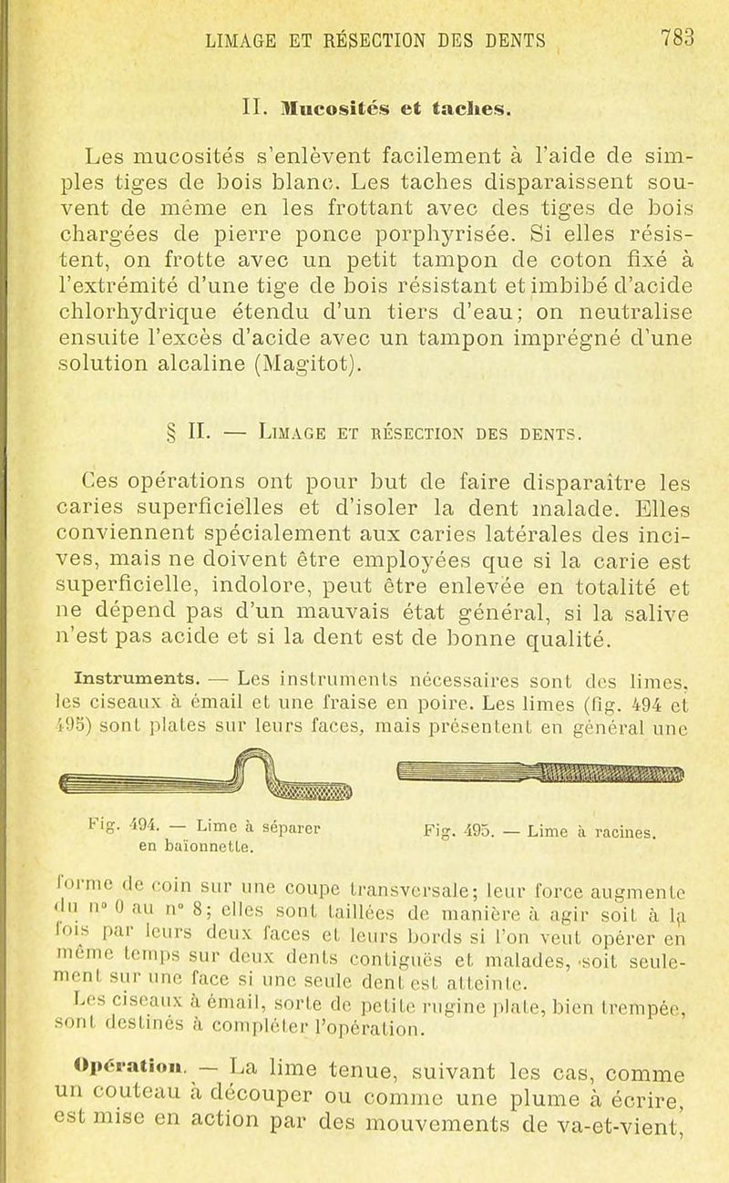II. mucosités et taches. Les mucosités s'enlèvent facilement à l'aide de sim- ples tiges de bois blanc. Les taches disparaissent sou- vent de même en les frottant avec des tiges de bois chargées de pierre ponce porphyrisée. Si elles résis- tent, on frotte avec un petit tampon de coton fixé à l'extrémité d'une tige de bois résistant et imbibé d'acide chlorhydrique étendu d'un tiers d'eau; on neutralise ensuite l'excès d'acide avec un tampon imprégné d'une solution alcaline (Magitot). § II. — Limage et résection des dents. Ces opérations ont pour but de faire disparaître les caries superficielles et d'isoler la dent malade. Elles conviennent spécialement aux caries latérales des inci- ves, mais ne doivent être employées que si la carie est superficielle, indolore, peut être enlevée en totalité et ne dépend pas d'un mauvais état général, si la salive n'est pas acide et si la dent est de bonne qualité. Instruments. — Les inslrumenls nécessaires sont des limes, les ciseaux à émail et une fraise en poire. Les limes (fig. 494 et i95) sont plates sur leurs faces, mais présentent en général une Fig. m. — Lime à séparer Fig. -195. — Lime ii racines, en buïonnelLe. lorme de coin sur une coupe transversale; leur force augmente <ln no 0 au n 8; elles sont taillées de manière à agir soit à Içi lois par leurs deux faces et leurs bords si l'on veut opérer en même temps sur deux dents contiguës et malades, -soit seule- ment sur une face si une seule dent est atteinte. Les ciseaux à émail, sorte de petite rugine plate, bien trempée, sont destinés à compléter l'opération. Opération. — La lime tenue, suivant les cas, comme un couteau à découper ou comme une plume à écrire, est mise en action par des mouvements de va-et-vient'