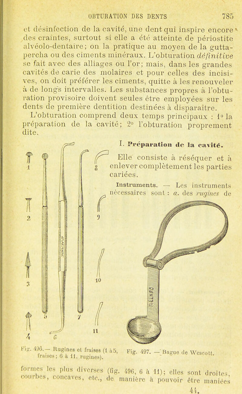et désinfection de la cavité, une dent qui inspire encore* des craintes, surtout si elle a été atteinte de périostite alvéolo-dentaire ; on la pratique au moyen de la gutta- percha ou des ciments minéraux. L'obturation définitive se fait avec des alliages ou l'or; mais, dans les grandes cavités de carie des molaires et pour celles des incisi- ves, on doit préférer les ciments, quitte à les renouveler à de longes intervalles. Les substances propres à l'obtu- ration provisoire doivent seules être employées sur les dents de première dentition destinées à disparaître. L'obturation comprend deux temps principaux : 1» la préparation de la cavité; 2° l'obturation proprement dite. L Préparation de la cavité. Elle consiste à réséquer et à ,<{ enlever complètement les parties cariées. Instruments. — Les instruments nécessaires sont : a. des rugines de l-'if,'. 496.— Rugines el fraises (1 à 5, fraises; 6 à 11, rugines). Fig. 497. Bague de Wcscolt. formes les plus diverses (fig. 496, 6 à 11); elles sont droites courbes, concaves, etc., de manière à pouvoir être maniocs