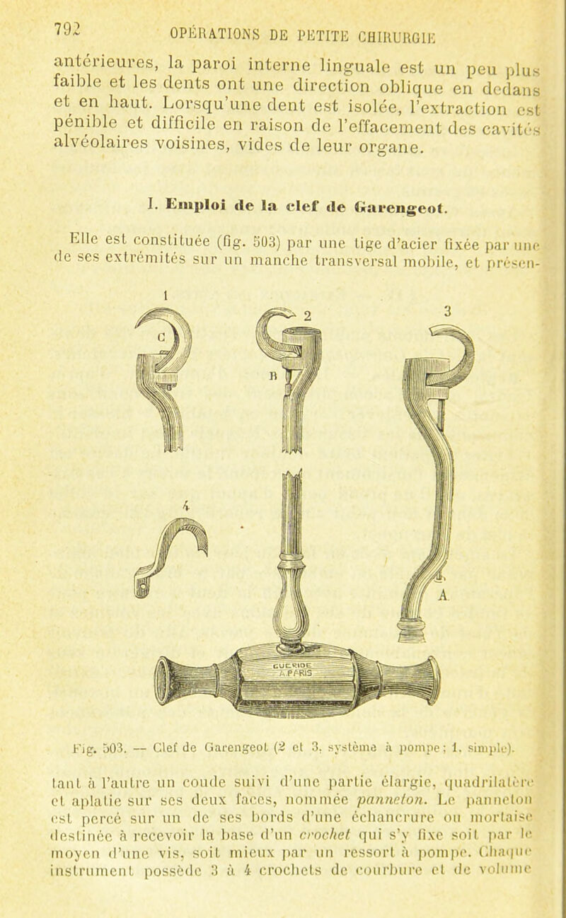 antérieures, la paroi interne linguale est un peu plus faible et les dents ont une direction oblique en dedans et en haut. Lorsqu'une dent est isolée, l'extraction est pénible et difficile en raison de l'effacement des cavités alvéolaires voisines, vides de leur organe. I. Emploi de la clef de Gavengeot. Elle est constituée (fig. 503) par une tige d'acier fixée par une (le ses extrémités sur un manche transversal mobile, et présen- l-'ig. 503. — Clef de Gai'engeol (2 et 3, système à iioinpe ; 1. simple). tant à l'autre un coude suivi d'une partie élargie, cpiadrilalcrc et aplatie sur ses deux faces, nommée panneton. Le panneton rst percé sur un de ses bords d'une échancrure ou mortaise destinée à recevoir la l)ase d'un crochet qui s'y fixe soit j»ar Ii; moyen d'une vis, soit mieux par un ressort à pompe. (;ha(|n(' instrument possède 3 à 4 crochets de courbure el de volnruc