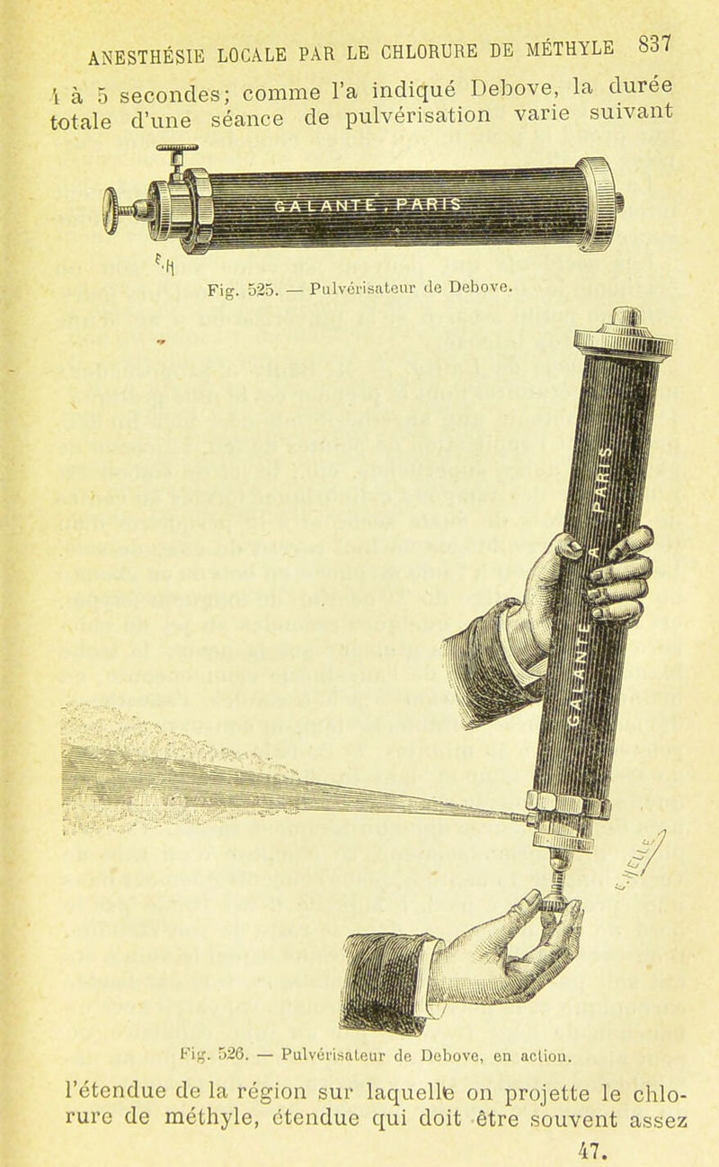 'i à 5 secondes; comme l'a indiqué Debove, la durée totale d'une séance de pulvérisation varie suivant Fifj. 526. — Pulvérisateur de Dobove, en action. l'étendue de la région sur laquelle on projette le chlo- rure de méthyle, étendue qui doit être souvent assez 47.